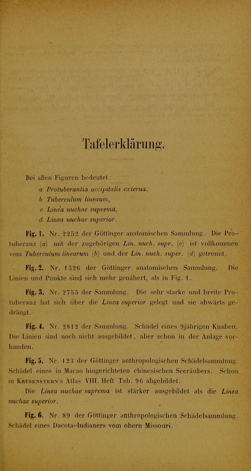 Tafelerklärung. Bei allen Figuren bedeiitcl : a Protuberanlia occipitalis externa, b Tuberculum lineaum, c Linea nuchae suprema, d Linea nuchae superior. Kig. 1. Nr. '2 252 der Göttinger anatomischen Sammlung. Die Pro- tuberanz (a) mit der zugehörigen Lin. nuch. supr. (c) ist vollkommen vom Tuberculum linear um (6) und der Lin. nuch. super, {d) gelrennt. Fif^. 3. Nr. 1326 der GöUinger anatomischen Sammlung. Die Linien und Punkte sind sich mehr genähert, als in Fig. \. h'ig. 3. Nr. 2755 der Sammlung. Die sehr starke und breite Pro- tuberanz hat sich über die Lmm superior gelegt und sie abwärts ge- drängt. Kig. 4. Nr. 2812 der Sammlung. Schädel eines 9jährigen Knaben. Die Linien sind noch nicht ausgebildet, aber schon in der Anlage vor- handen. Fig. 5. Nr. 12.3 der Göttinger anlhropologisdien Schädelsammlung. Schädel eines in Macao hingerichteten chinesischen Seeräubers. Schon in Krusenstern's Atlas VIII. Heft Tab. 96 abgebildet. Die Linea nuchae suprema ist stärker ausgebildet als die Lmea nuchae superior. Hg. 6. Nr. 89 der Göttinger anthropologischen Schädelsammlung. Schädel eines Dacota-Indianers vom obern Missouri.