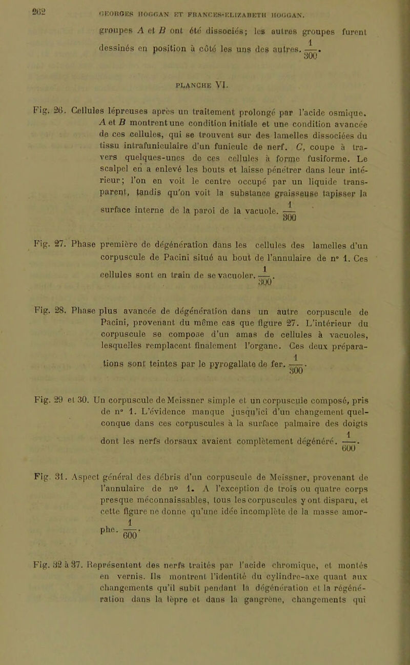 '!K0nGE(5 lIOOfiAN KT FKANCKS-KLI/ABETH IIOOGAN. groupes A ol B ont été dissociés; les autres groupes furent dessinés on position à côté les uns des autres.^—. P1,ANCHE VI. Fig. 2l3. Cellules lépreuses après un Irailement prolongé par l'acide osmiquc, A et B montrent une condition initiale et une condition avancée de ces cellules, qui se trouvent sur des lamelles dissociées du tissu intrafuniculaire d'un funicule de nerf. C, coupe à tra- vers quelques-unes de ces cellules à forme fusiforme. Le scalpel en a enlevé les bouts et laisse pénétrer dans leur inté- rieur; l'on en voit le centre occupé par un liquide trans- parent, tandis qu'on voit la substance graisseuse tapisser la 1 surface interne de la paroi de la vacuole. — 300 Fig. 27. Phase première de dégénération dans les cellules des lamelles d'un corpuscule de Pacini situé au bout de l'annulaire de n> 1. Ces cellules sont en train de se vacuoler.. m Fig. 28, Phase plus avancée de dégéncralion dans un autre corpuscule de Pacini, provenant du même cas que figure 27. L'intérieur du corpuscule se compose d'un amas de cellules à vacuoles, lesquelles remplacent finalement l'organe. Ces deux prépara- 1 lions sont temtes par le pyroeallate de fer. ' * 300 Fig. 29 et 30. Un corpuscule deMeissncr simple et un corpuscule composé, pris de n 1. L'évidence manque jusqu'ici d'un changement quel- conque dans ces corpuscules à la surface palmaire des doigts 1 dont les nerfs dorsaux avaient complètement dégénéré. Fig. 31. Aspect général des débris d'un corpuscule de Meissner, provenant de l'annulaire de n 1. A l'exception de trois ou quatre corps presque méconnaissables, tous les corpuscules y ont disparu, et cette figure ne donne qu'une idée incomplète de la niasse amor- Fig. 32 à 37. lioprésentenl des nerfs traités par l'acide chromique, et montés en vernis. Ils monlronl l'identité du cylindre-axe quant aux changements qu'il subit pendant la dégénéralion el la régéné- ration dans la lèpre et dans la gangrène, changements qui