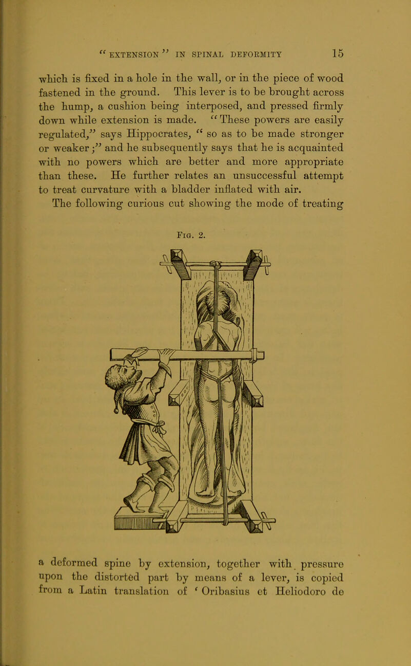 wliicli is fixed in a hole in tlie wall, or in tlie piece of wood fastened in tlie ground. This lever is to be brought across the hump, a cushion being interposed, and pressed firmly- down while extension is made. These powers are easily- regulated, says Hippocrates, so as to be made stronger or weakerand he subsequently says that he is acquainted with no powers which are better and more appropriate than these. He further relates an unsuccessful attempt to treat curvature with a bladder inflated with air. The following curious cut showing the mode of treating Fm. 2. a deformed spine by extension, together with pressure upon the distorted part by means of a lever, is copied from a Latin translation of ' Oribasius et Heliodoro de