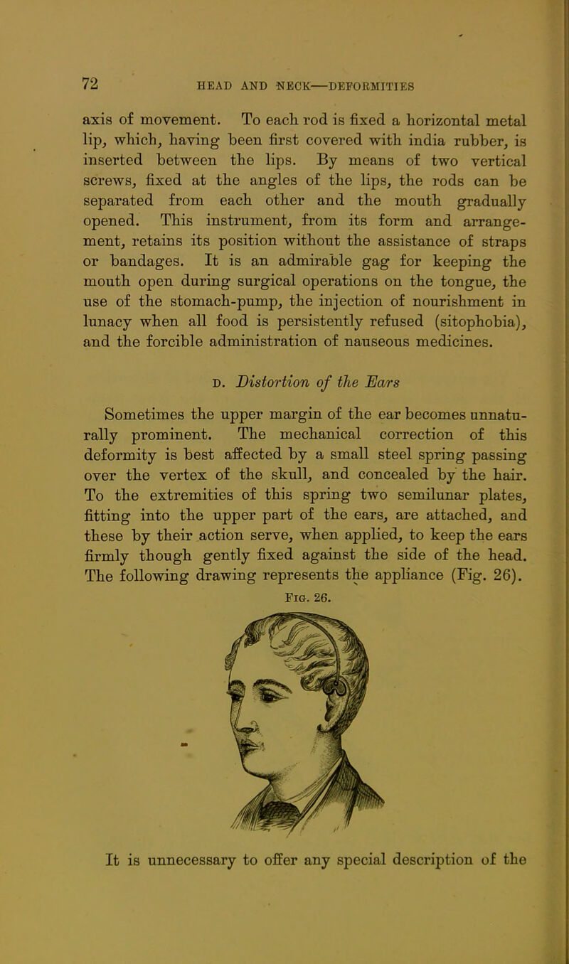 axis of movement. To eacli rod is fixed a horizontal metal lip, which, having been first covered with india rubber, is inserted between the lips. By means of two vertical screws, fixed at the angles of the lips, the rods can be separated from each other and the mouth gradually opened. This instrument, from its form and arrange- ment, retains its position without the assistance of straps or bandages. It is an admirable gag for keeping the mouth open during surgical operations on the tongue, the use of the stomach-pump, the injection of nourishment in lunacy when all food is persistently refused (sitophobia), and the forcible administration of nauseous medicines. D. Distortion of the Ears Sometimes the upper margin of the ear becomes unnatu- rally prominent. The mechanical correction of this deformity is best affected by a small steel spring passing over the vertex of the skull, and concealed by the hair. To the extremities of this spring two semilunar plates, fitting into the upper part of the ears, are attached, and these by their action serve, when applied, to keep the ears firmly though gently fixed against the side of the head. The following drawing represents the appliance (Fig. 26). Fia. 26. It is unnecessary to offer any special description of the