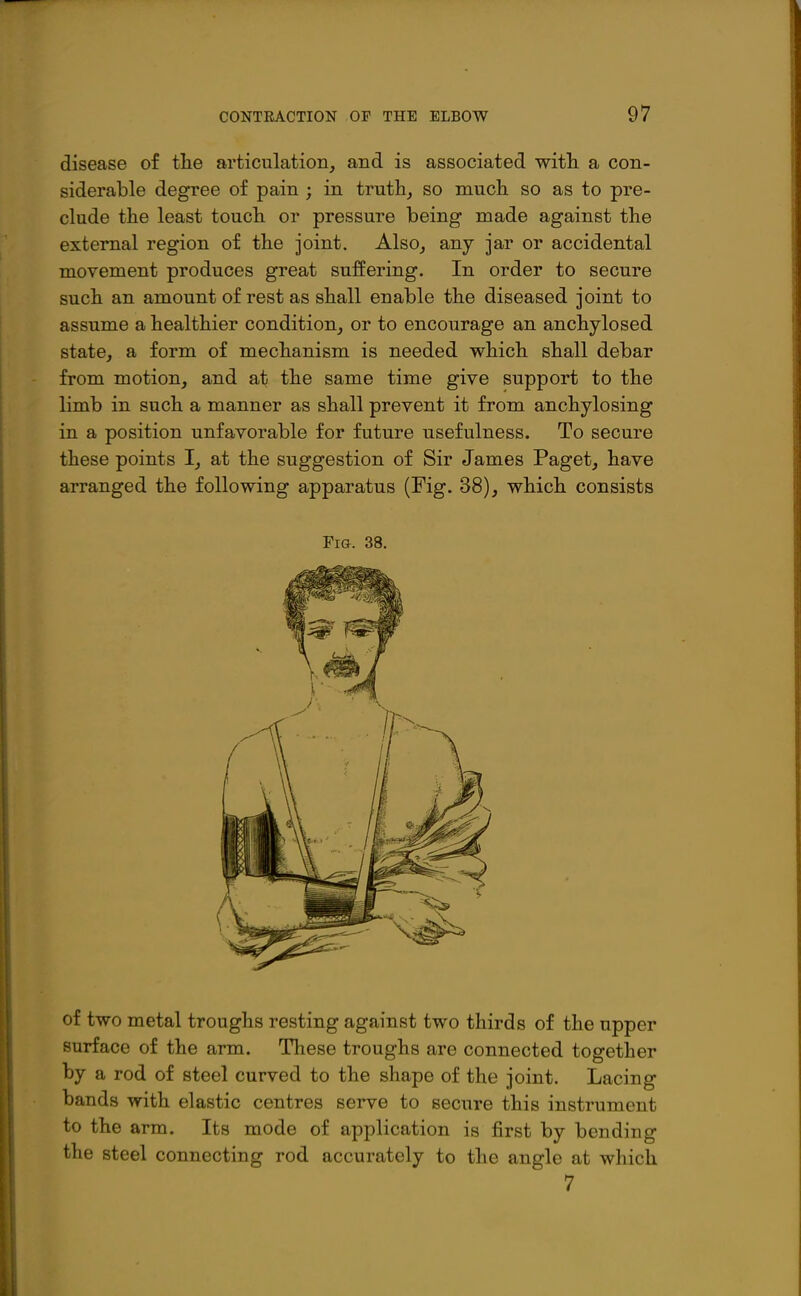 disease of the articulation, and is associated witli a con- siderable degree of pain ; in truth, so much so as to pre- clude the least touch or pressure being made against the external region of the joint. Also, any jar or accidental movement produces great suffering. In order to secure such an amount of rest as shall enable the diseased joint to assume a healthier condition, or to encourage an anchylosed state, a form of mechanism is needed which shall debar from motion, and at the same time give support to the limb in such a manner as shall prevent it from anchylosing in a position unfavorable for future usefulness. To secure these points I, at the suggestion of Sir James Paget, have arranged the following apparatus (Fig. 38), which consists Fia. 38. of two metal troughs resting against two thirds of the upper surface of the arm. These troughs are connected together by a rod of steel curved to the shape of the joint, bands with elastic centres serve to secure this instrument to the arm. Its mode of application is first by bending the steel connecting rod accurately to the angle at which. 7