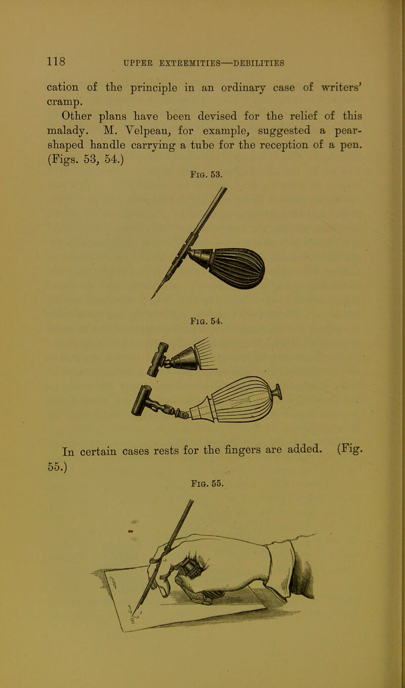 cation of the principle in an ordinary case of writers^ cramp. Other plans have been devised for the relief of this malady. M. Yelpeau, for example, suggested a pear- shaped handle carrying a tube for the reception of a pen. (Figs. 53, 54.) Fig. 53. In certain cases rests for the fingers are added. (Fig. 55.)