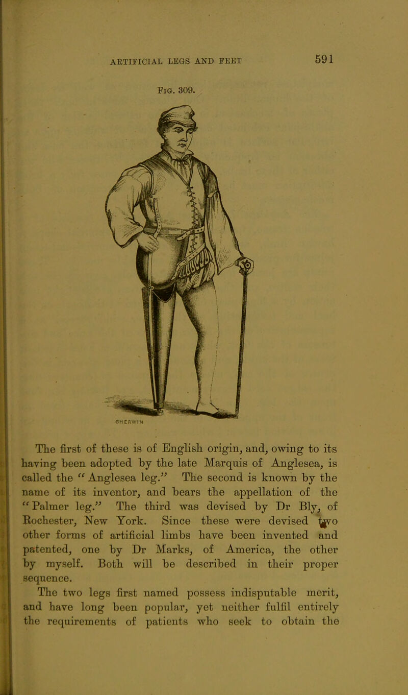 Fig. 309. The first of these is of English origin, and, owing to its having been adopted by the late Marquis of Anglesea, is called the  Anglesea leg.^^ The second is known by the name of its inventor, and bears the appellation of the Palmer leg. The third was devised by Dr Bly, of Rochester, New York. Since these were devised ^o other forms of artificial limbs have been invented and patented, one by Dr Marks, of America, the other by myself. Both will be described in their proper sequence. The two legs first named possess indisputable merit, and have long been popular, yet neither fulfil entirely the requirements of patients who seek to obtain the