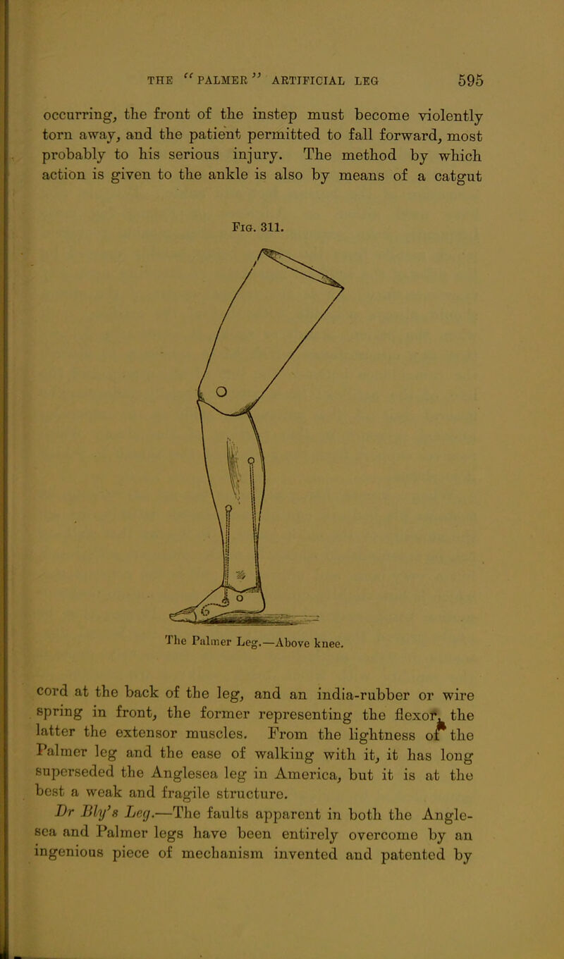 occurring, the front of the instep must become violently torn away, and the patient permitted to fall forward, most probably to his serious injury. The method by which action is given to the ankle is also by means of a catgut Fig. 311. The Palmer Leg.—Above knee. cord at the back of the leg, and an india-rubber or wire spring in front, the former representing the flexof, the latter the extensor muscles. From the lightness orthe Palmer leg and the ease of walking with it, it has long superseded the Anglesea leg in America, but it is at the best a weak and fragile structure. Dr Ely's Leg.—The faults apparent in both the Angle- sea and Palmer legs have been entirely overcome by an ingenious piece of mechanism invented and patented by