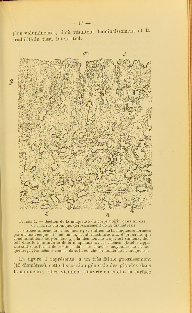 plus volumineuses, d'où résultent ramincissement et friabilité du tissu interstitiel. cr- ^ 0, surface interne de la muqueuse; s, sivillies delà muqueuse formées par un tissu conjonctif enflammé, et intermédiaires aux dépressions qui conduisent dans les glandes; g, glandes dont le trajet est sinueux, den- telé dans le tiers interne de la muqueuse ; k, ces mômes çlandos appa- raissant sous forme de sections dans les couches moyennes de la mu- queuse; 7i, les mêmes coupes dans la couche profonde de la muqueuse. La figure 1 représente,' à un très faible grossissement (15 diamètres), cotte disposition générale des glandes dans la muqueuse. Elles viennent s'ouvrir en cfict à la surface