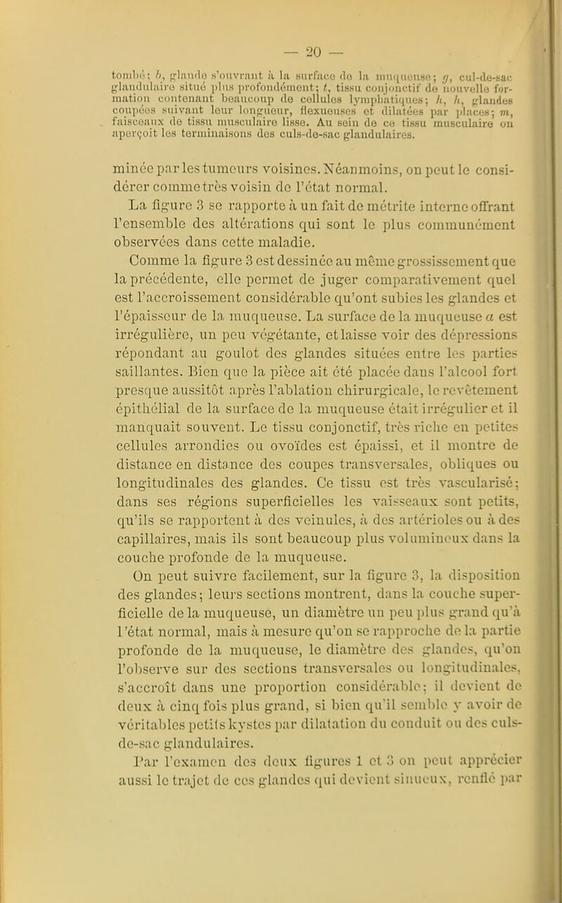 tonil))';; h, frlîuulo s'ouvr.iiit ;i la surface do la nuinueuse; r/, cul-de-sac glandiilaii-e situé i)lus i)i-ofuiidéineiit: t, tissu coujonctif de 'nouvelle for- mation contenant beaucoup de cellules lynipliatiques; h, h, friandes coupées suivant leur loiipruour, fiexuouses et dilatées par iilaces; m, faisceaux do tissu musculaire lisse. Au sein de ce tissu musculaire on aper(;oit les teruiiuaisous des culs-de-sac glandulaires. minée par les tumeurs voisines. Néanmoins, on peut le consi- dérer comme très voisin de l'état normal. La figure 3 se rapporte à un fait de métrite interne offrant l'ensemlDle des altérations qui sont le plus communément observées dans cette maladie. Comme la fip^ure 3 est dessinée au même grossissement que la précédente, elle permet de juger comparativement quel est l'accroissement considérable qu'ont subies les glandes et l'épaisseur de la muqueuse. La surface de la muqueuse a est irrégulière, un peu végétante, et laisse voir des dépressions répondant au goulot des glandes situées entre k's parties saillantes. Bien que la pièce ait été placée dans l'alcool fort presque aussitôt après l'ablation chirurgicale, le revêtement épithélial de la surface de la muqueuse était irrégulier et il manquait souvent. Le tissu conjonctif, très l'iche en petites cellules arrondies ou ovoïdes est épaissi, et il montre de distance en distance des coupes transversales, obliques ou longitudinales des glandes. Ce tissu est très vascularisé; dans ses régions superficielles les vaisseaux sont petits, qu'ils se rapportent à des veinules, à des artériolesou à des capillaires, mais ils sont beaucoup plus volumineux dans la couche profonde de la muqueuse. On peut suivre facilement, sur la figure 3, la disposition des glandes; leurs sections montrent, dans la couche super- ficielle de la muqueuse, un diamètre un peu plus grand qu'à l'état normal, mais à mesure qu'on se rapproche do la partie profonde de la muqueuse, le diamètre des glandes, qu'on l'observe sur des sections transversales ou longitudinales, s'accroît dans une proportion considérable; il devient de deux à cinq fois plus gi-and, si l)ion qu'il semble y avoir de vérital)les petits kystes par dilatation du conduit ou des culs- de-sac glandulaires. Par l'cxamcu des deux figures 1 eton peut apprécier aussi le trajet de ces glandes qui devient sinueux, renflé jiar