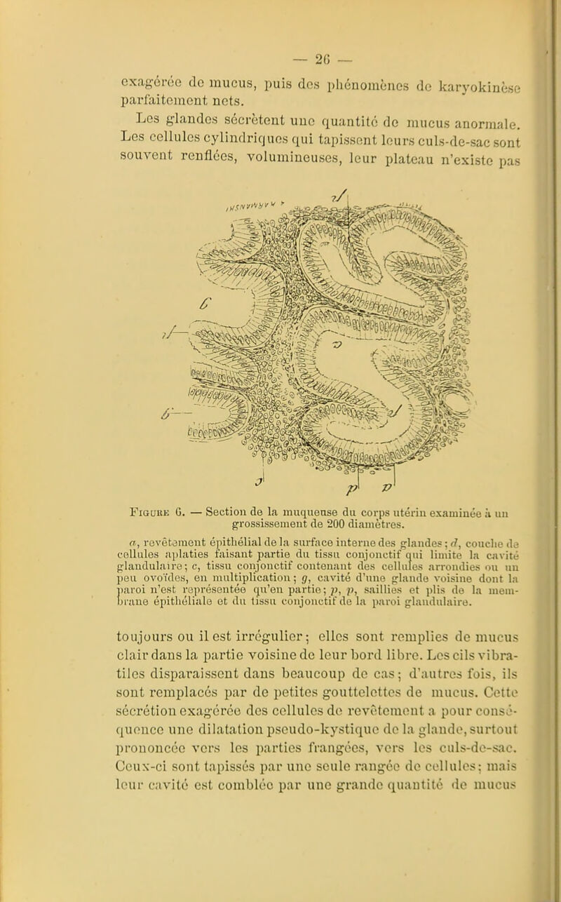 exagérée de mucus, puis des phénomènes de karyokinèse parfaitement nets. Les glandes sécrètent une quantité de mucus anormale. Les cellules cylindricjues qui tapissent leurs culs-de-sac sont souvent renflées, volumineuses, leur plateau n'existe pas FiGuuE G. — Section de la muquease du corps utérin examinée à uu grossissement de 200 diamètres. a, revêtement épitliélial de la surface interne des glandes ; rf, couclie de cellules ajilaties taisant partie du tissu conjonctif qui lin\ite la aivité plaudulaire ; c, tissu conjonctif contenant des cellules arrondies <)u un l)eu ovoïdes, en multiplication ; g, cavité d'une glande voisine dont la îiaroi n'est représentée qu'en partie; p, saillies et plis de la meni- Inaue épitliélialo et du tissu conjonctif de la paroi glandulaire. toujours ou il est irrégulier; elles sont remplies de mucus clair dans la partie voisine de leur bord libre. Los cils vibra- tiles disparaissent dans beaucoup de cas ; d'autres fois, ils sont remplacés par de petites gouttelettes de mucus. Cette sécrétion exagérée des cellules do revêtement a pour consé- quence une dilatation pseudo-kystique de la glande, surtout prononcée vers les parties frangées, vers les culs-de-sac. Ceux-ci sont tapissés par une seule rangée de cellules; mais leur cavité est comblée par une grande quantité de mucus