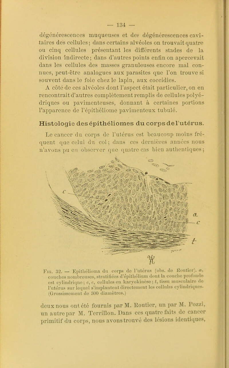 — 1:54 — dégénérescences muqueuses et des dégénérescences cavi- taires des cellules; dans certains alvéoles on trouvait quatre ou cinq cellules présentant les différents stades de la division indirecte; dans d'autres points enfin on apercevait dans les cellules des musses granuleuses encore mal con- nues, peut-être analogues aux parasites que l'on trouve si souvent dans le foie chez le lapin, aux coccidies. A côte de ces alvéoles dont l'aspect était particulier, on en rencontrait d'autres complètement remplis de cellules polyé- driques ou pavimenteuses, donnant à certaines portions l'apparence do l'épitliéliome pavimenteux tubulé. Histologie desépithéliomes du corps de l'utérus. Le cancer du corps do l'utérus est beaucoup moins fré- quent qLie celui du col; dans ces dernières années nous n'avons pu en observer que quatre cas bien autlienliques; c t FiG. 32. — Epitliélionia du corps do rtiténis (olis. do lîouticr;. a, couches uniiil)i-ou.sos, stnitiHucs d'épitliolium dont la couclie profonde ost cylindriiiiie; c, c, cellules en karyokinose : t, tissu niusi-ulairc do l'utérus sur loijUGl s'iniplantout directouiont les collul.-s cylindriiines. (Gro.ssissuinout de iîUO diamètres.) deux nous ont été fournis par M. Routier, un par M. l'ozzi, un autre par M. Tcrrillon. Dans ces quatre faits de cancer primitif du corps, nous avons trouvé des lésions identiques,