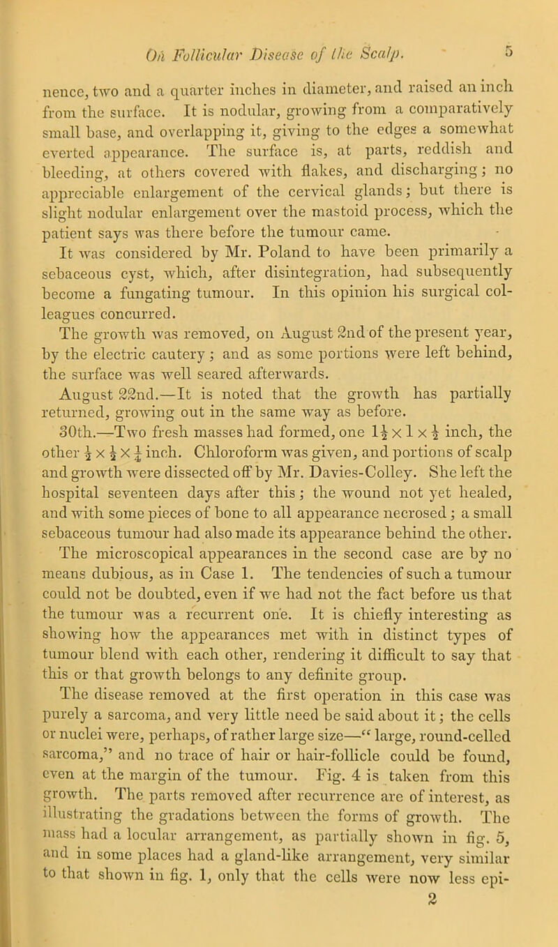 nence, two and a quarter inches in diameter, and raised an inch from the surface. It is nodular, growing from a comiDaratively small base, and overlapping it, giving to the edges a somewhat everted appearance. The surface is, at parts, reddish and bleeding, at others covered with flakes, and discharging; no appreciable enlargement of the cervical glands; but there is slight nodular enlargement over the mastoid process, which the patient says was there before the tumour came. It was considered by Mr. Poland to have been primarily a sebaceous cyst, which, after disintegration, had subsequently become a fungating tumour. In this opinion his surgical col- leagues concurred. The growth was removed, on August 2nd of the present year, by the electric cautery; and as some portions were left behind, the surface was well seared afterwards. August S2nd.—It is noted that the growth has partially returned, growing out in the same way as before. 30th.—Two fresh masses had formed, one 1^ x 1 x 2 inch, the other ^ X ^ X1 inch. Chloroform was given, and portions of scalp and growth were dissected off by Mr. Davies-Colley. She left the hospital seventeen days after this; the wound not yet healed, and with some pieces of bone to all appearance necrosed ; a small sebaceous tumour had also made its appearance behind the other. The microscopical appearances in the second case are by no means dubious, as in Case 1. The tendencies of such a tumour could not be doubted, even if we had not the fact before us that the tumour was a recurrent one. It is chiefly interesting as showing how the appearances met with in distinct types of tumour blend with each other, rendering it difficult to say that this or that groAvth belongs to any definite group. The disease removed at the first operation in this case was purely a sarcoma, and very little need be said about it; the cells or nuclei were, perhaps, of rather large size— large, round-celled sarcoma, and no trace of hair or hair-follicle could be found, even at the margin of the tumour. Fig. 4 is taken from this growth. The parts removed after recurrence are of interest, as illustrating the gradations between the forms of growth. The mass had a locular arrangement, as partially shown in fig. 5, and in some places had a gland-like arrangement, very similar to that shown in fig. 1, only that the cells were now less epi- 2