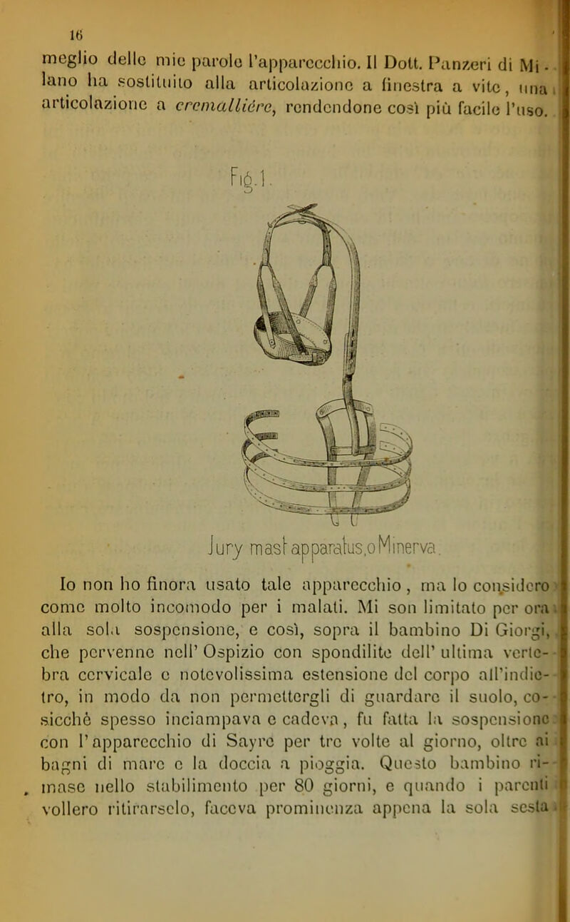 meglio delle mie parole l'apparecchio. Il Dott. Zanzeri di Mi.. lano ha soslitiiiio alla articolazione a (iriestra a vite, uimi articolazione a creniallióre, rendendone cosi più facile l'uso. Fi^.l. Jury masiapparalus.oMinerva. Io non ho finora usato tale apparecchio, ma lo coi\sidcro^ come molto incomodo per i maiali. Mi son limitato per ora» alla sola sospensione, e così, sopra il bambino Di Giorgi,, che pervenne nell'Ospizio con spondilite dell'ultima verte-- bra cervicale e notevolissima estensione del corpo all'indio-- tro, in modo da non permettergli di guardare il suolo, co-- .sicché spesso inciampava e cadeva, fu fatta la sospensionoj con l'apparecchio di Sayre per tre volte al giorno, oltre ai i bagni di mare e la doccia a pioggia. Questo bambino ri-- , masc nello stabilimento per 80 giorni, e quando i parenti t vollero ritirarselo, faceva prominenza appena la sola sestai