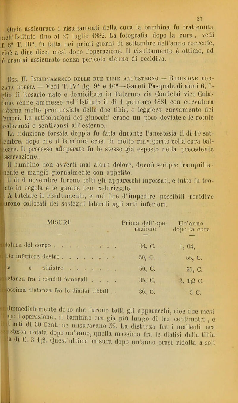 Onde assicurare i risulta menti della cura la bambina fu trattenuta nell'Istituto fino al 27 luglio 1882. La fotografìa dopo la cura, vedi f. 8 T. Ili, fa fatta nei primi giorni di settemlìre dcH'aniio corrente, cioè a dire dicci mesi dopo l'operazione. Il risultamento è ottimo, ed è oramai assicurato senza pericolo alcuno di recidiva. Oss. II. Incurvamento delle due tibie all'estp:rno — Riduzione for- zata DOPPIA — Vedi T. IV' fìg. 9* e 10—Garull Pasquale di anni 6, tì- glio di Rosario, nato e domiciliato in Palermo via Candelai vico Gala- iano, venne ammesso Jiell'Istituto il dì i gennaro 1881 con curvatura esterna molto pronunziata delle due tibie, e leggiero curvamente dei emori. Le articolazioni dei ginocchi erano un poco deviate e le rotule yedevansi e senlivansi all'esterno. La riduzione forzata doppia fu fatta durante l'anestesia il di 19 set- lembre, dopo che il bambino erasi di molto rinvigorito colla cura bal- eare. Il processo adoperato fu lo stesso già esposto nella precedente sservazione. 11 bambino non avverti mai alcun dolore, dormì sempre tranquilla- ente e mangiò giornalmente con appetito. Il dì 6 novembre furono tolti gli apparecchi ingessati, e tutto fu tro- ato in regola e le gambe ben raddrizzate. . A tutelare il risultamento, e nel Une d'impedire possibili recidive reno collocali dei sostegni laterali agli arti inferiori. MISURE atura del corpo te inferiore destro » » sinistro istanza fra i condili femorali . . . . SSima d stanza fra le diaflsi tibiali . Prima dell'epe Un'anno razione dopo la cura 96, C. 1, 04, 50, C. •55, C. 50, C. 55, C. 35, C. 2, li2 C. 36, C. 3 C. mmcd lata me lite dopo che furono tolti gli apparecchi, cioè due mesi po l'operazione, il bambino era già più lungo di tre cent'mclri , c ■ di 50 Cent, ne misuravano m. La distinza fra i malleoli era . notala dopo un'anno, quella massima fra le dialisi della tibia I. 3 1|2. Quest'ultima misura dopo un'anno crasi ridotta asoli