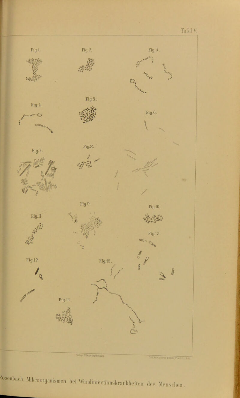 Tafel V. Fig.l. Füj.2. M Fig.3. Ki(j.+ . ruj.5. ***** t #•* Fig.6. \ Fig.7. Fig.ll. 4 Fig.12. Fig.8. Fig.9. / Fig.15. Fig.14-. Fig. 10. Fig.I.3. s p \ s ■I'. Miki-oor(,anisi„.-n h.., Wi,n.l,.,r.M.iio„sk,v„,klHMir„ .l. s .Mrn.s.luM,