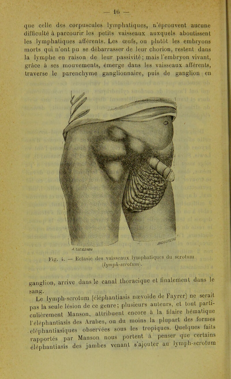 — 10 — que celle des corpuscules lympliatiqucs, n'éprouvent aucune diniculté à parcourir les pcLils vaisseaux auxquels aboutissent les lymphatiques afférents. Les œufs, ou plutôt les embryons morts qui n'ont pu se débarrasser de leur chorion, restent dans la lymplie en raison de leur passivité ; mais l'embryon vivant, grâce à ses mouvements, émerge dans les vaisseaux afférents, traverse le parenchyme ganglionnaire, puis de ganglion en .i. — Ectasie des vaisseaux lyiuphaliqucs du scruluiu {lymph-scrolunù. ganglion, arrive dans le canal thoracique et finalement dans le sang. Le lymph-scrotum (ôléphanliasis nœvoïde de Fayrer) ne serait pas la seule lésion de ce genre; plusieurs auteurs, et tout parti- culièrement Manson, attribuent encore à la iilaire hémalique l'éléphanliasis des Arabes, ou du moins la plupart des formes .eléphantiasiques obserVées sous les tropiques. Quelques faits rapportés par Manson nous portent à penser que certains élépliantiasis des jambes venant s'ajouter au lymph-scrolura