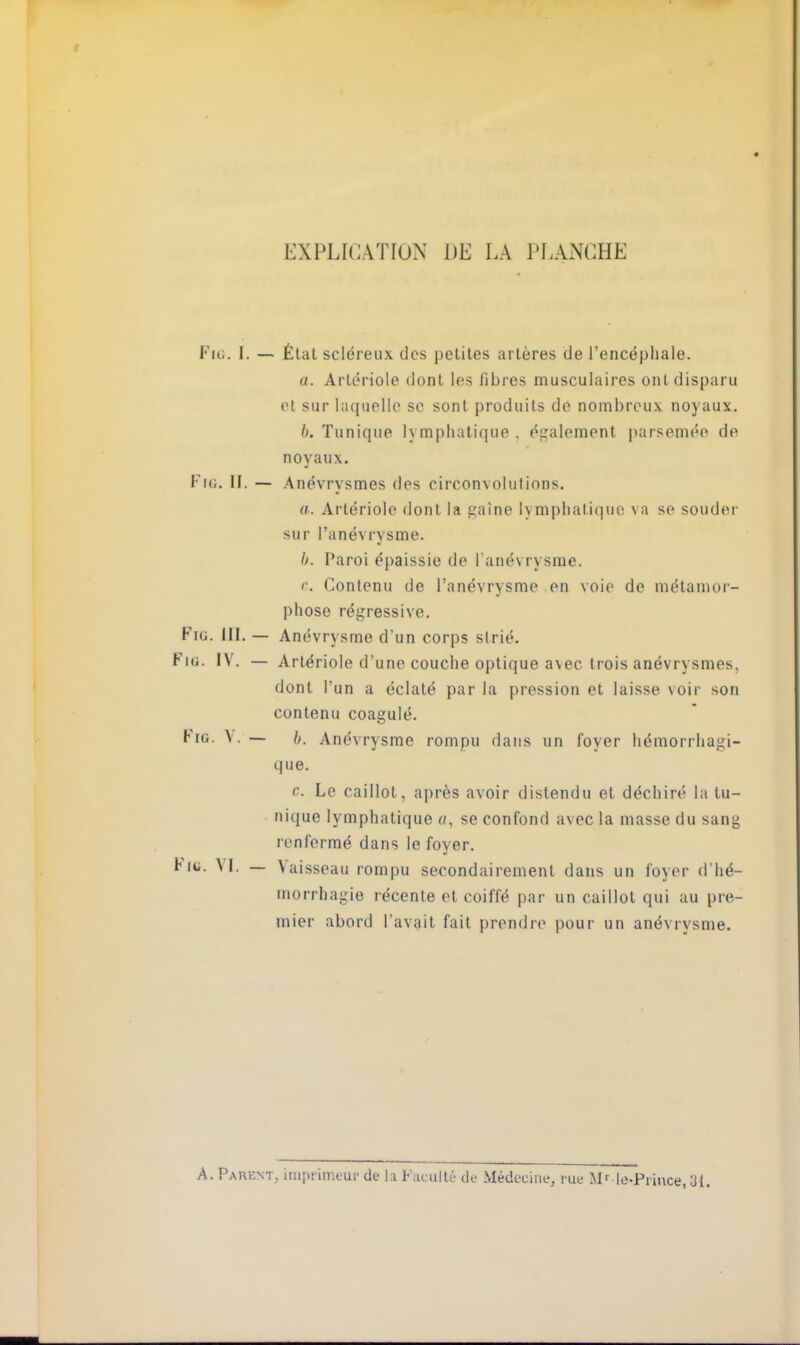 EXPLICATION DE LA PLANCHE Fie. I. — État scléreux des petites artères de l'encéphale. a. Artériole dont les fibres musculaires ont disparu el sur laquelle se sont produits de nombreux noyaux. b. Tunique lymphatique, également parsemée de noyaux. Fie. II. — Anévrysmes des circonvolutions. a. Artériole dont la gaine lymphatique va se souder sur l'anévrysme. b. Paroi épaissie de l'anévrysme. c. Contenu de l'anévrysme en voie de métamor- phose régressive. Fiu. UI. — Anévrysme d'un corps strié. Fie. IV. — Artériole d'une couche optique avec trois anévrysmes, dont l'un a éclaté par la pression et laisse voir son contenu coagulé. Hg. \ .— b. Anévrysme rompu dans un foyer hémorrhagi- que. c. Le caillot, après avoir distendu et déchiré la tu- nique lymphatique a, se confond avec la masse du sang renfermé dans le foyer. Fie. VI. — Vaisseau rompu secondairement dans un foyer d'hé- morrhagie récente et coiffé par un caillot qui au pre- mier abord l'avait fait prendre pour un anévrysme. A. Parent, imprimeur de la Faculté de Médecine, rue Mr le-Pi ince, 84.