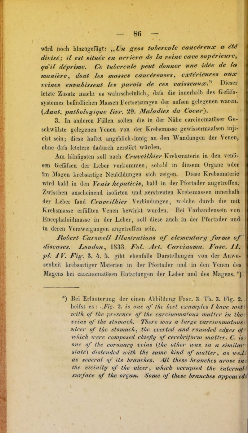 wird noch hlnzngefilgt: „f7» gros tuhercvle catiUreiia; a divis^; il est sitn4e en arriere de la veine cave svpcricnre^ gu il deprime. Ce tubercnle pevt dotmer vne Idee de la tnaniere^ dont les masses canc^renses, ext^rieures aua: veines envaliisseut les parois de ces vaisseana:.'''' Dieser letzte Zusatz macht es wahrscheinhch, dafs die innerhalb des Gefafs- systemes befindlichen Massen Fortsetzungen der aufsen gelegenen waren. {Anat. patJiologiqve livr. 29. Maladies du Coeur'). 3. In anderen Fallen sollen die in der Tsähe carcinomatöser Ge- schwülste gelegenen >'enen von der Krebsmasse gewissermaafsen inji- cirt sein; diese haftet angeblich.innig an den Wandungen der Venen, ohne dafs letztere dadurch zerstört würden. Am hänfigsten soll nach Cruveil/iier Krebsmaterie in den venö- sen Gefäfsen der Leber vorkommen, sobald in diesem Organe oder im Magen krebsartige Neubildungen sich zeigen. Diese Krebsmaterie wird bald in den Venis hcpalicis^ bald in der Pfortader angetroffen. Zwischen ansclieincnd isolirten und verstreuten Krebsmassen innerhalb der Leber fand Cruveilhier Verbindungen, w-'lche durch die mit Krebsmasse erfüllten Venen bewirkt wurden. Bei A'orhandensein von Encephaloidmasse in der Leber, soll diese anch in der Pfortader und in deren Verzweigungen angetroffen sein. Robert Carswcll Illiislratiom of elementary forms of diseases. Ltondoii.^ 1833. Fol. Art. Carcinoma. Fase. JJ. pl. JV. Fig: 3. h. 5. gibt ebenfalls Darstellungen von der Anwe- senheit krebsartiger Materien in der Pfortader und in den Venen des Magens b(!i carciuomatösen Entartungen der Leber und des Magens.') *) Bei Erläuterung der einen Abbildung Fase. 3. Tb. 3. Fig. 2. hcifst es : ..Fiü. 2. is one of llte liest exn?nples 1 finve in et ii'ith of the piu scnce of the carcinoniahnis maller in t/n veins of the stoniac/i. There tvas a Inrge carcinotnatous nlcer of the stowac/i^ the everted and rounded edges oj vhick u erc conipnsed chieflij of cerehriform matter. V. t.s one of the coronary veins {the ot/ier was in a similar State) distended with the same kind of matteras wed as several of its hranches. ML these hranches nrose in the vicinitij of the ulcer, which occupied the internal siirface of the organ. Some these //ranc/ies appearedl \