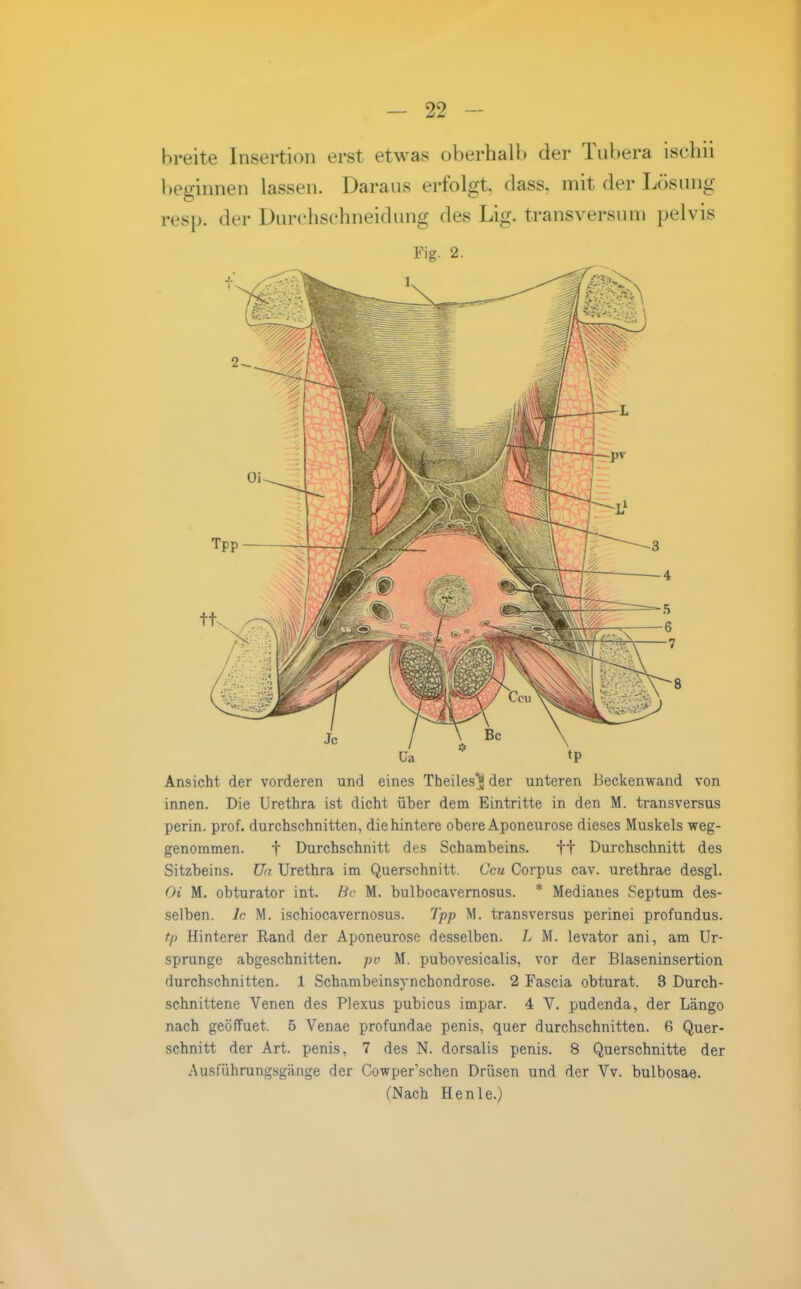 breite Insertion erst etwas oberhalb der Tubera ischii beginnen lassen. Daraus erfolgt, dass. mit der Lösung resjj. der Durehschneidung des Lig. transversum pelvis Fig. 2. Ansicht der vorderen und eines Theiles^ der unteren Beckenwand von innen. Die Urethra ist dicht über dem Eintritte in den M. transversus perin. prof. durchschnitten, die hintere obere Aponeurose dieses Muskels weg- genommen, t Durchschnitt des Schambeins. tt Durchschnitt des Sitzbeins, üa Urethra im Querschnitt. Ccu Corpus cav. urethrae desgl. Oi M. obturator int. Hc M. bulbocavernosus. * Medianes Septum des- selben. Ic M. ischiocavernosus. Tpp M. transversus perinei profundus. tp Hinterer Rand der Aponeurose desselben. L M. levator ani, am Ur- sprünge abgeschnitten, pv M. pubovesicalis, vor der Blaseninsertion durchschnitten. 1 Schambeinsynchondrose. 2 Fascia obturat. 3 Durch- schnittene Venen des Plexus pubicus impar. 4 V. pudenda, der Längo nach geöffuet. 5 Venae profundae penis, quer durchschnitten. 6 Quer- schnitt der Art. penis, 7 des N. dorsalis penis. 8 Querschnitte der Ausführungsgänge der Cowper'schen Drüsen und der Vv. bulbosae.
