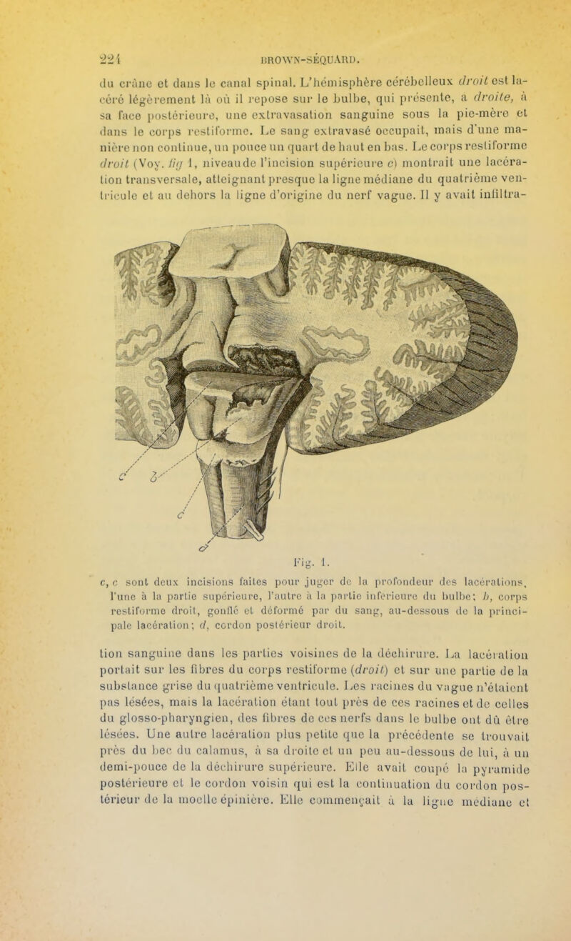 -22\ IiROWN-SÉQUARU. du crâne et dans lo canal spinal. L'hémisphère cérébelleux droit est la- céré légèrement là où il repose sur le bulbe, qui présente, à droite, à sa lace postérieure, une extravasatioh sanguine sous la pic-mère et dans le corps restiforme. Le sang extravasé occupait, mais d'une ma- nière non continue, un pouce un quart de haut en bas. Le corps restiforme droit (Voy. âg 1, niveaude l'incision supérieure c) montrait une lacéra- lion transversale, atteignant presque la ligne médiane du quatrième ven- tricule et au dehors la ligne d'origine du nerf vague. Il y avait infiltra- C, c sont deux incisions faites pour juger de la profondeur des lacérations, l'une à la partie supérieure, l'autre à la partie inférieure du bulbe; h, corps restiforme droit, gonflé et déformé par du sang, au-dessous de la princi- pale lacération; (t, cordon postérieur droit. lion sanguine dans les parties voisines de la déchirure. La lacération portait sur les fibres du corps restiforme (droit) et sur une partie de la substance grise du quatrième ventricule. Les racines du vague n'étaient pas lésées, mais la lacération étant tout près de ces racines et de celles du glosso-pharyngien, des fibres de ces nerfs dans le bulbe ont dû être lésées. Une autre lacération plus petite que la précédente se trouvait près du bec du calamus, à sa droite cl un peu au-dessous de lui à un demi-pouce de la déchirure supérieure. Elle avait coupé la pyramide postérieure et le cordon voisin qui est la continuation du cordon pos- térieur de la moelle épinière. Elle commençait à lu ligue médiane et