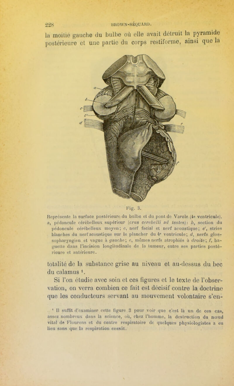 £28 HKOWN-SÉQUAHD. la moilie gauche du bulbe où elle avait détruit la pyramide postérieure et une partie du corps restiforme, ainsi que la Pig. 3. Représente la surface postérieure du bulbe cl du puni de Varole (4e ventricule). a, pédoncule cérébelleux supérieur (crus ccrebelli ad testes) : bs section du pédoncule cérébelleux moyen; c, nerf facial cl nerf acoustique; c', slries blanches du cerf acoustique sur le plancher du 4* ventricule; (/, nerfs glos- sopharyngien et vague à gauche; e, mêmes nerfs atrophiés à droite; /', ba- guette dans l'incision longitudinale de la tumeur, entre ses parties posté- rieure et antérieure. totalité de la substance grise au niveau et au-dessus du bec du calamus 1. Si l'on étudie avec soin et ces figures et le texte de l'obser- vation, on verra combien ce fait est décisif contre la doctrine que les conducteurs servant au mouvement volontaire s'en- 1 II suffit d'examiner eette figure 3 pour voir que c'est là un de ces cas, assez nombreux dans la science, où, chez l'homme, la destruction du nœud vilal de Flourcns et du centre respiratoire de quelques physiologistes a eu lieu sans que la respiration cessAt.