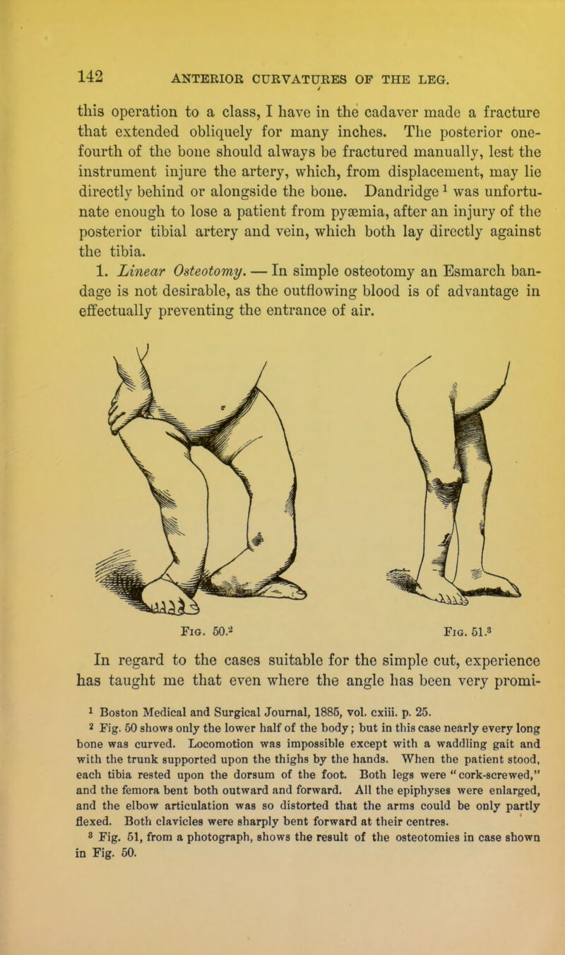 this operation to a class, I have in the cadaver made a fracture that extended obliquely for many inches. The posterior one- fourth of the bone should always be fractured manually, lest the instrument injure the artery, which, from displacement, may lie directly behind or alongside the bone. Dandridge1 was unfortu- nate enough to lose a patient from pyaemia, after an injury of the posterior tibial artery and vein, which both lay directly against the tibia. 1. Linear Osteotomy. — In simple osteotomy an Esmarch ban- dage is not desirable, as the outflowing blood is of advantage in effectually preventing the entrance of air. In regard to the cases suitable for the simple cut, experience has taught me that even where the angle has been very promi- 2 Fig. 50 shows only the lower half of the body; but in this case nearly every long bone was curved. Locomotion was impossible except with a waddling gait and with the trunk supported upon the thighs by the hands. When the patient stood, each tibia rested upon the dorsum of the foot. Both legs were cork-screwed, and the femora bent both outward and forward. All the epiphyses were enlarged, and the elbow articulation was so distorted that the arms could be only partly flexed. Both clavicles were sharply bent forward at their centres. 8 Fig. 51, from a photograph, shows the result of the osteotomies in case shown in Fig. 50. Fig. 50.* Fig. 51.3