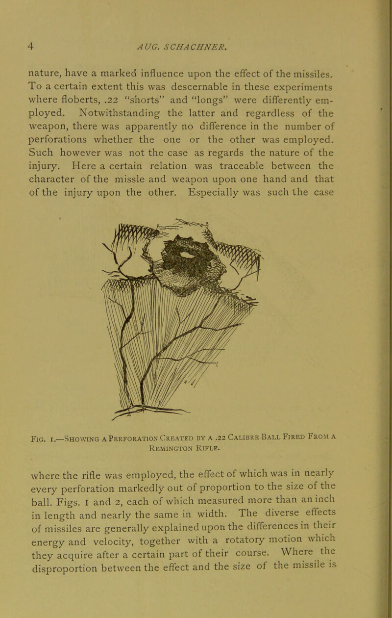 nature, have a marked influence upon the effect of the missiles. To a certain extent this was descernable in these experiments where floberts, .22 shorts and longs were differently em- ployed. Notwithstanding the latter and regardless of the weapon, there was apparently no difference in the number of perforations whether the one or the other was employed. Such however was not the case as regards the nature of the injury. Here a certain relation was traceable between the character of the missle and weapon upon one hand and that of the injury upon the other. Especially was such the case Fig. 1.—Showing a Perforation Created by a .22 Calibre Ball Fired From a Remington Rifle. where the rifle was employed, the effect of which was in nearly every perforation markedly out of proportion to the size of the ball. Figs. 1 and 2, each of which measured more than an inch in length and nearly the same in width. The diverse effects of missiles are generally explained upon the differences in their energy and velocity, together with a rotatory motion which they acquire after a certain part of their course. Where the disproportion between the effect and the size of the missile is