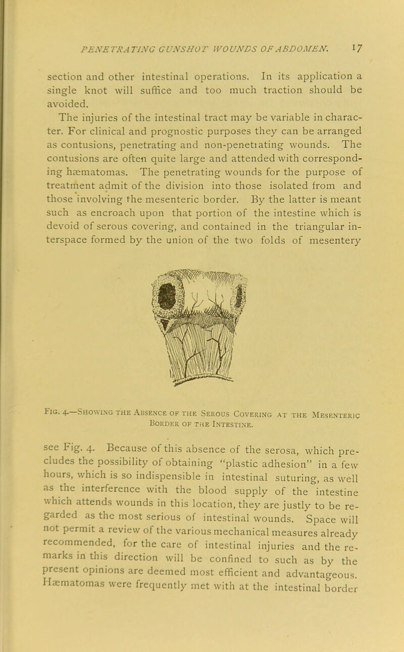 section and other intestinal operations. In its application a single knot will suffice and too much traction should be avoided. The injuries of the intestinal tract may be variable in charac- ter. For clinical and prognostic purposes they can be arranged as contusions, penetrating and non-penetiating wounds. The contusions are often quite large and attended with correspond- ing hematomas. The penetrating wounds for the purpose of treatment admit of the division into those isolated from and those involving the mesenteric border. By the latter is meant such as encroach upon that portion of the intestine which is devoid of serous covering, and contained in the triangular in- terspace formed by the union of the two folds of mesentery Fig. 4.—Showing the Absence of the Serous Covering at the Mesenteric Border of the Intestine. see Fig. 4. Because of this absence of the serosa, which pre- cludes the possibility of obtaining plastic adhesion in a few hours, which is so indispensible in intestinal suturing, as well as the interference with the blood supply of the intestine which attends wounds in this location, they are justly to be re- garded as the most serious of intestinal wounds. Space will not permit a review of the various mechanical measures already recommended, for the care of intestinal injuries and the re- marks in this direction will be confined to such as by the present opinions are deemed most efficient and advantageous. Haematomas were frequently met with at the intestinal border