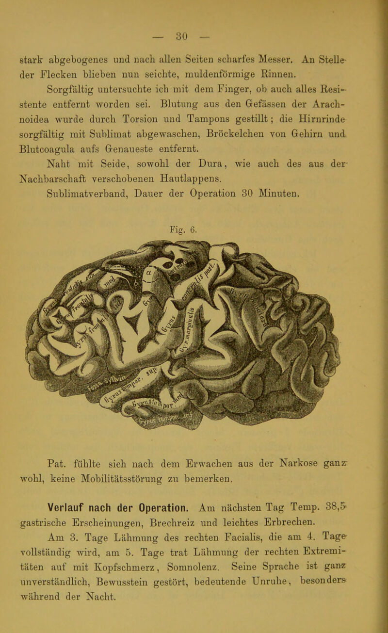 stark abgebogenes und nach allen Seiten scharfes Messer. An Stelle der Flecken blieben nun seichte, muldenförmige Rinnen. Sorgfältig untersuchte ich mit dem Finger, ob auch alles Resi- stente entfernt worden sei. Blutung aus den Gefässen der Arach- noidea wurde durch Torsion und Tampons gestillt; die Hirnrinde sorgfältig mit Sublimat abgewaschen, Bröckelchen von Gehirn und Blutcoagula aufs Genaueste entfernt. Naht mit Seide, sowohl der Dura, wie auch des aus der Nachbarschaft verschobenen Hautlappens. Sublimatverband, Dauer der Operation 30 Minuten. Fig. 6. Pat. fühlte sich nach dem Erwachen aus der Narkose ganz- wohl, keine Mobilitätsstörung zu bemerken. Verlauf nach der Operation. Am nächsten Tag Temp. 38,5 gastrische Erscheinungen, Brechreiz und leichtes Erbrechen. Am 3. Tage Lähmung des rechten Facialis, die am 4. Tage- vollständig wird, am 5. Tage trat Lähmung der rechten Extremi- täten auf mit Kopfschmerz, Somnolenz. Seine Sprache ist ganz unverständlich, Bewusstein gestört, bedeutende Unruhe, besonders während der Nacht.