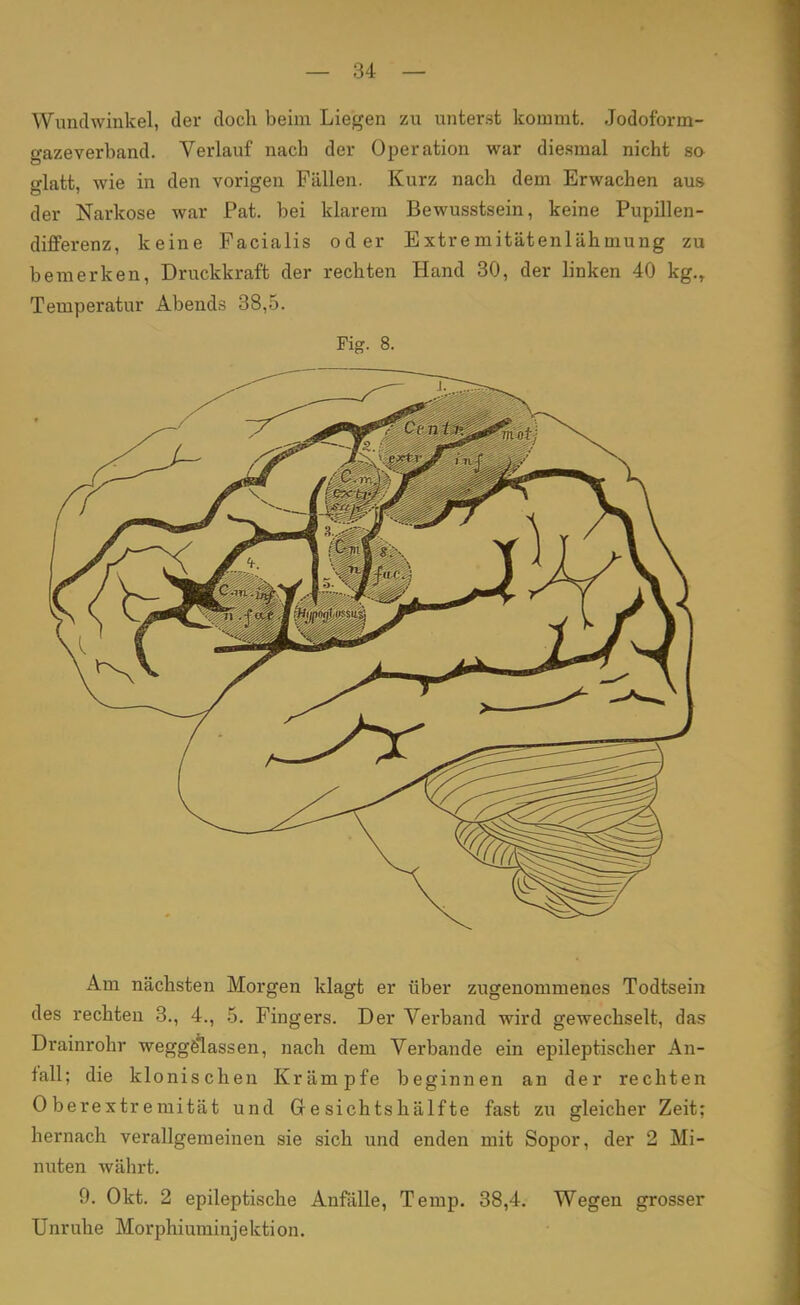 Wundwinkel, der doch beim Liegen zu unterst kommt. Jodoform- o-azeverband. Verlauf nach der Operation war diesmal nicht so glatt, wie in den vorigen Fällen. Kurz nach dem Erwachen aus der Narkose war Pat. bei klarem Bewusstsein, keine Pupillen- differenz, keine Facialis oder Extremitätenlähmung zu bemerken, Druckkraft der rechten Hand 30, der linken 40 kg., Temperatur Abends 38,5. Fig. 8. Am nächsten Morgen klagt er über zugenommenes Todtsein des rechten 3., 4., 5. Fingers. Der Verband wird gewechselt, das Drainrohr weggelassen, nach dem Verbände ein epileptischer An- fall; die klonischen Krämpfe beginnen an der rechten Oberextreniität und Gesichtshälfte fast zu gleicher Zeit; hernach verallgemeinen sie sich und enden mit Sopor, der 2 Mi- nuten währt. 9. Okt. 2 epileptische Anfälle, Temp. 38,4. Wegen grosser Unruhe Morphiuminjektion.