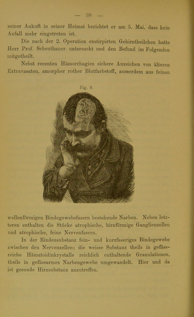 seiner Ankuft in seiner Heimat berichtet er am 5. Mai, dass kein Anfall mehr eingetreten ist. Die nach der 2. Operation exstirpirten Gehirntheilchen hatte Herr Prof. Scheuthauer untersucht und den Befund im Folgenden mitgetheilt. Nebst recenten Hämorrhagien sichere Anzeichen von älteren Extravasaten, amorpher rother Blutfarbstoff, ausserdem aus feinen Fig. 9. wellenförmigen Bindegewebsfasern bestehende Narben. Neben letz- teren enthalten die Stücke atrophische, birnförmige Ganglienzellen und atrophische, feine Nervenfasern. In der Rindensubstanz fein- und kurzfaseriges Bindegewebe zwischen den Nervenzellen; die weisse Substanz theils in gefäss- reiche Hämatoidinkrystalle reichlich enthaltende Granulationen, theils in gefässarmes Narbengewebe umgewandelt. Hier und da ist gesunde Hirnsubstanz anzutreffen.