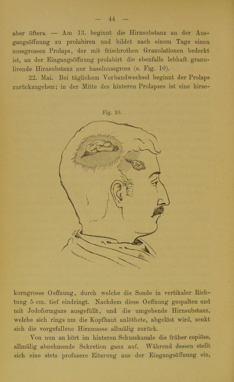 aber öfters. — Am 13. beginnt die Hirnsubstanz an der Aus- gangsöffnung zu prolabiren und bildet nach einem Tage einen nussgrossen Prolaps, der mit frischrothen Granulationen bedeckt ist, an der Eingangsöffnung prolabirt die ebenfalls lebhaft granu- lirende Hirnsubstanz nur haselnussgross (s. Fig. 10). 22. Mai. Bei täglichem Verbandwechsel beginnt der Prolaps zurückzugehen; in der Mitte des hinteren Prolapses ist eine hirse- Fig. 10. korngrosse Oeffnung, durch welche die Sonde in vertikaler Rich- tung 5 cm. tief eindringt. Nachdem diese Oeffnung gespalten und mit Jodoformgaze ausgefüllt, und die umgebende Hirnsubstanz, welche sich rings um die Kopfhaut anlöthete, abgelöst wird, senkt sich die vorgefallene Hirnmasse allmälig zurück. Von nun an hört im hinteren Schusskanale die früher copiöse, allmälig abnehmende Sekretion ganz auf. Während dessen stellt sich eine stets profusere Eiterung aus der Eingangsöffnung ein,