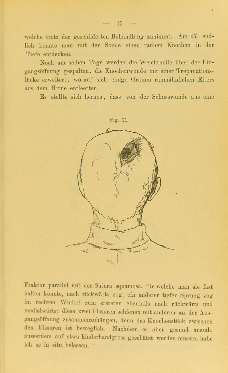welche trotz der geschilderten Behandlung zunimmt. Am 27. end- lich konnte man mit der Sonde einen rauhen Knochen in der Tiefe entdecken. Noch am selben Tage werden die Weichtheile über der Ein- gangsöffhung gespalten, die Knochenwunde mit einer Trepanations- lücke erweitert, worauf sich einige Gramm rahmähnlichen Eiters aus dem Hirne entleerten. Es stellte sich heraus, dass von der Schusswunde aus eine Fig. 11. Fraktur parallel mit der Sutura squamosa, für welche man sie fast halten konnte, naeh rückwärts zog, ein anderer tiefer Sprung zog im rechten Winkel zum ersteren ebenfalls nach rückwärts und medialwärts; diese zwei Fissuren schienen mit anderen an der Aus- gangsöffnung zusammenzuhängen, denn das Knochenstück zwischen den Fissuren ist beweglich. Nachdem es aber gesund aussah, ausserdem auf etwa kinderhandgross geschätzt werden musste, habe ich es in situ belassen.