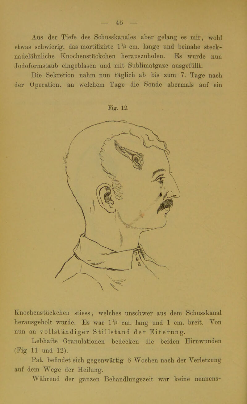 Aus der Tiefe des Schusskanales aber gelang es mir, wohl etwas schwierig, das mortifizirte l1/2 cm. lange und beinahe steck- nadelähnliche Knochenstückchen herauszuholen. Es wurde nun Jodoformstaub eingeblasen und mit Sublimatgaze ausgefüllt. Die Sekretion nahm nun täglich ab bis zum 7. Tage nach der Operation, an welchem Tage die Sonde abermals auf ein Fig. 12. Knochenstückchen stiess, welches unschwer aus dem Schusskanal herausgeholt wurde. Es war l1/2 cm. lang und 1 cm. breit. Von nun an vollständiger Stillstand der Eiterung. Lebhafte Granulationen bedecken die beiden Hirnwunden (Fig 11 und 12). Pat. befindet sich gegenwärtig 6 Wochen nach der Verletzung auf dem Wege der Heilung. Während der ganzen Behandlungszeit war keine nennens-