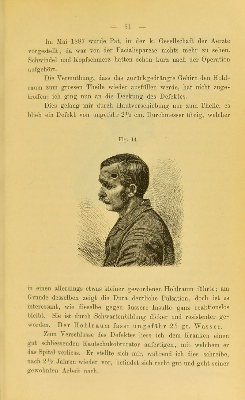 Im Mai 1887 wurde Pat. in der k. Gesellschaft der Aerzte vorgestellt, da war von der Facialisparese nichts mehr zu sehen. Schwindel und Kopfschmerz hatten schon kurz nach der Operation aufgehört. Die Vermuthung, dass das zurückgedrängte Gehirn den Hohl- raum zum grossen Theile wieder ausfüllen werde, hat nicht zuge- troffen; ich ging nun an die Deckung des Defektes. Dies gelang mir durch Hautverschiebung nur zum Theile, es blieb ein Defekt von ungefähr 21/2 cm. Durchmesser übrig, welcher Fig. 14. in einen allerdings etwas kleiner gewordenen Hohlraum führte; am Grunde desselben zeigt die Dura deutliche Pulsation, doch ist es interessant, wie dieselbe gegen äussere Insulte ganz reaktionslos bleibt. Sie ist durch Schwartenbildung dicker und resistenter ge- worden. Der Hohlraum fasst ungefähr 25 gr. Wasser. Zum Verschlusse des Defektes liess ich dem Kranken einen gut schliessenden Kautschukobturator anfertigen, mit welchem er das Spital verliess. Er stellte sich mir, während ich dies schreibe, nach 2J/2 Jahren wieder vor, befindet sich recht gut und geht seiner gewohnten Arbeit nach.