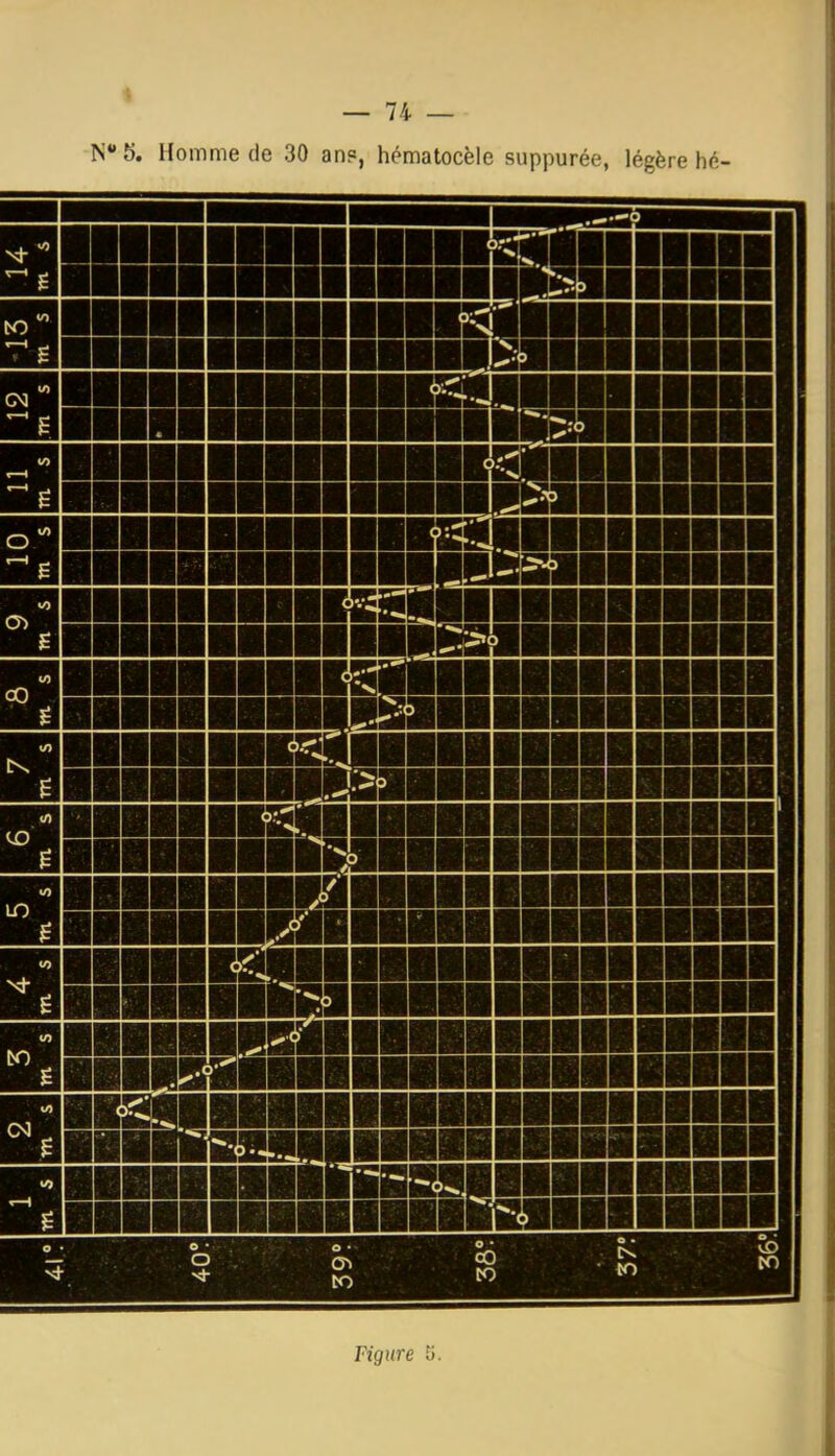 N 5. Homme de 30 an?, hématocèle suppurée, légère hé- Figure U. J