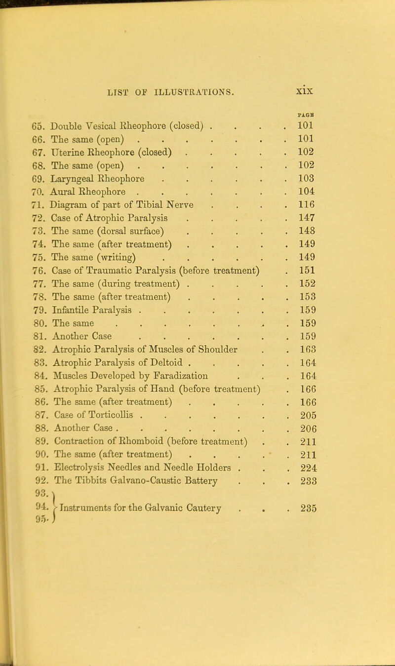 FAGB 65. Doixble Vesical Klieophore (closed) .... 101 66. The same (open) 101 67. TTterine Eheophore (closed) 102 68. The same (open) 102 69. Laryngeal Eheophore . . . . . .103 70. Aural Eheophore ....... 104 71. Diagram of part of Tibial Nerve .... 116 72. Case of Atrophic Paralysis ..... 147 73. The same (dorsal surface) ..... 148 74. The same (after treatment) ..... 149 75. The same (writing) ...... 149 76. Case of Traumatic Paralysis (before treatment) . 151 77. The same (during treatment) ..... 152 78. The same (after treatment) ..... 153 79. Infantile Paralysis 159 80. The same . 159 81. Another Case ....... 159 82. Atrophic Paralysis of Muscles of Shoulder . .163 83. Atrophic Paralysis of Deltoid . . . . .164 84. Muscles Developed by Faradization . . .164 85. Atrophic Paralysis of Hand (before treatment) . 166 86. The same (after treatment) . . . . .166 87. Ca-se of Toi-ticollis 205 88. Another Case 206 89. Contraction of Rhomboid (before treatment) . . 211 90. The same (after treatment) 211 91. Electrolysis Needles and Needle Holders . . . 224 92. The Tibbits Galvano-Caustic Battery . . .233 93. ^ 94. ^ Instruments for the Galvanic Cautery . . . 235 95-)