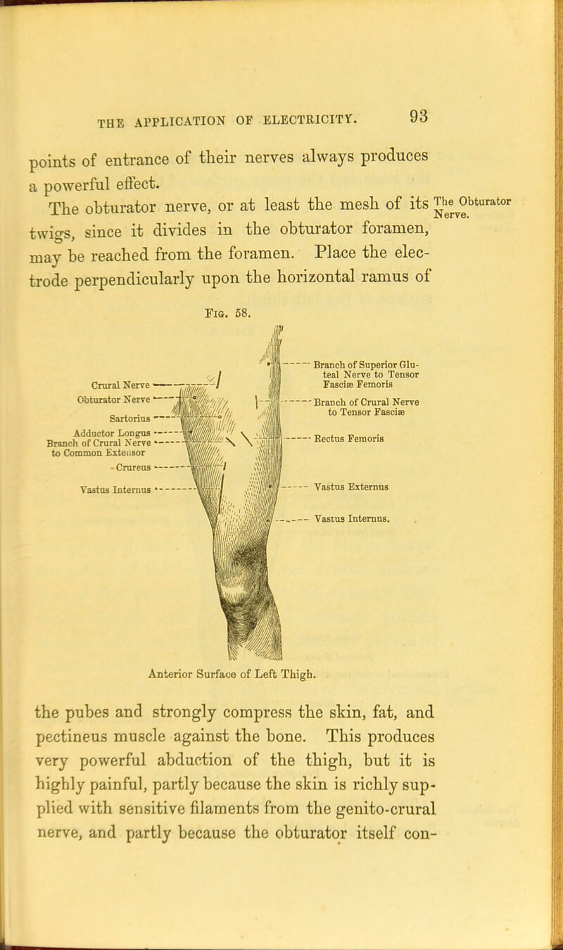 points of entrance of their nerves always produces a powerful effect. The obturator nerve, or at least the mesh of its JJ'^^^ twites since it divides in the obturator foramen, may be reached from the foramen. Place the elec- trode perpendicularly upon the horizontal ramus of Fig. 58. Crural Nerve Obturator Nerve —— Sartorlns Adductor Longus Branch of Crural Xerve to Common Extensor - Cmrens - Vastus Internus ' Branch of Superior Glu- teal Nerve to Tensor Fasciae Femoris Branch of Crural Nerve to Tensor Fascise — Rectus Femoris Vastus Externus Vastus Internus. Anterior Surface of Left Thigh. the pubes and strongly compress the skin, fat, and pectineus muscle against the bone. This produces very powerful abduction of the thigh, but it is highly painful, partly because the skin is richly sup- plied with sensitive filaments from the genito-crural nerve, and partly because the obturator itself con-