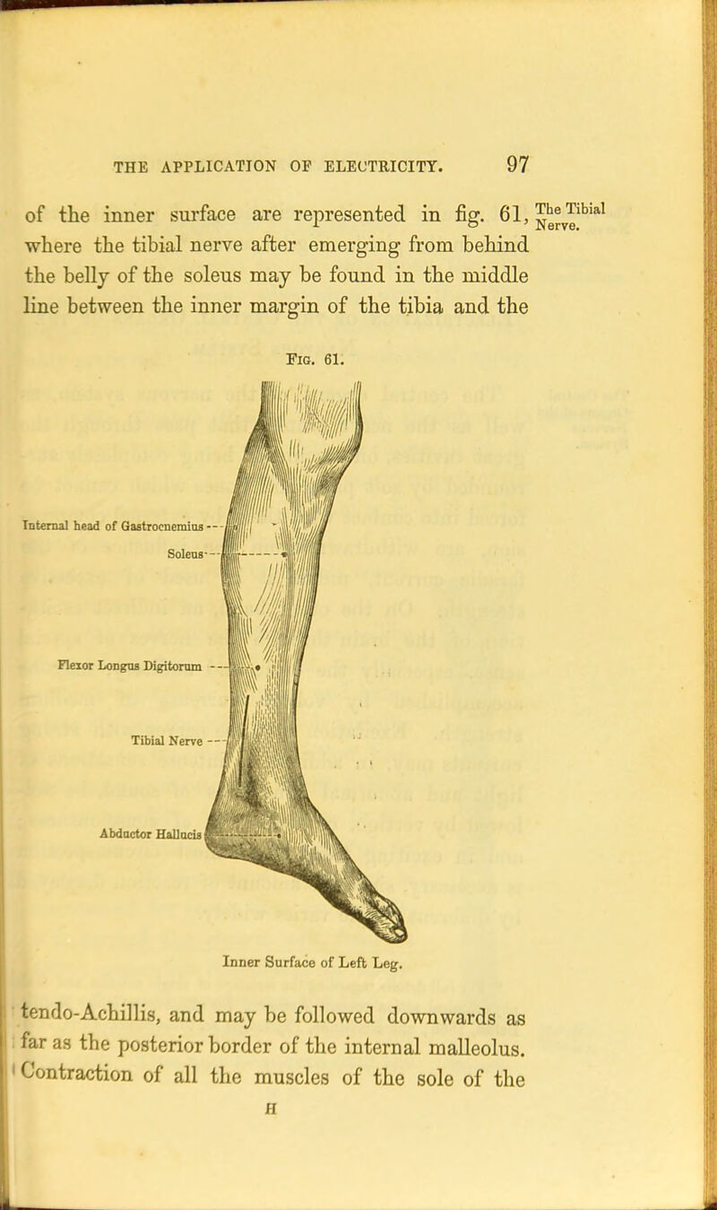 of the inner surface are represented in fig. 61, ^^^7!'^'*^ where the tibial nerve after emerging from behind the bellj of the soleus may be found in the middle line between the inner margin of the tibia and the Fig. 61. Internal head of Qastrocnemios SolenB Flexor Longos Digitomm - Tibial Nerve - Abductor Hallocia Inner Surface of Lefl Leg. ' tendo-Achillis, and may be followed downwards as : far as the posterior border of the internal malleolus. • Contraction of all the muscles of the sole of the fl