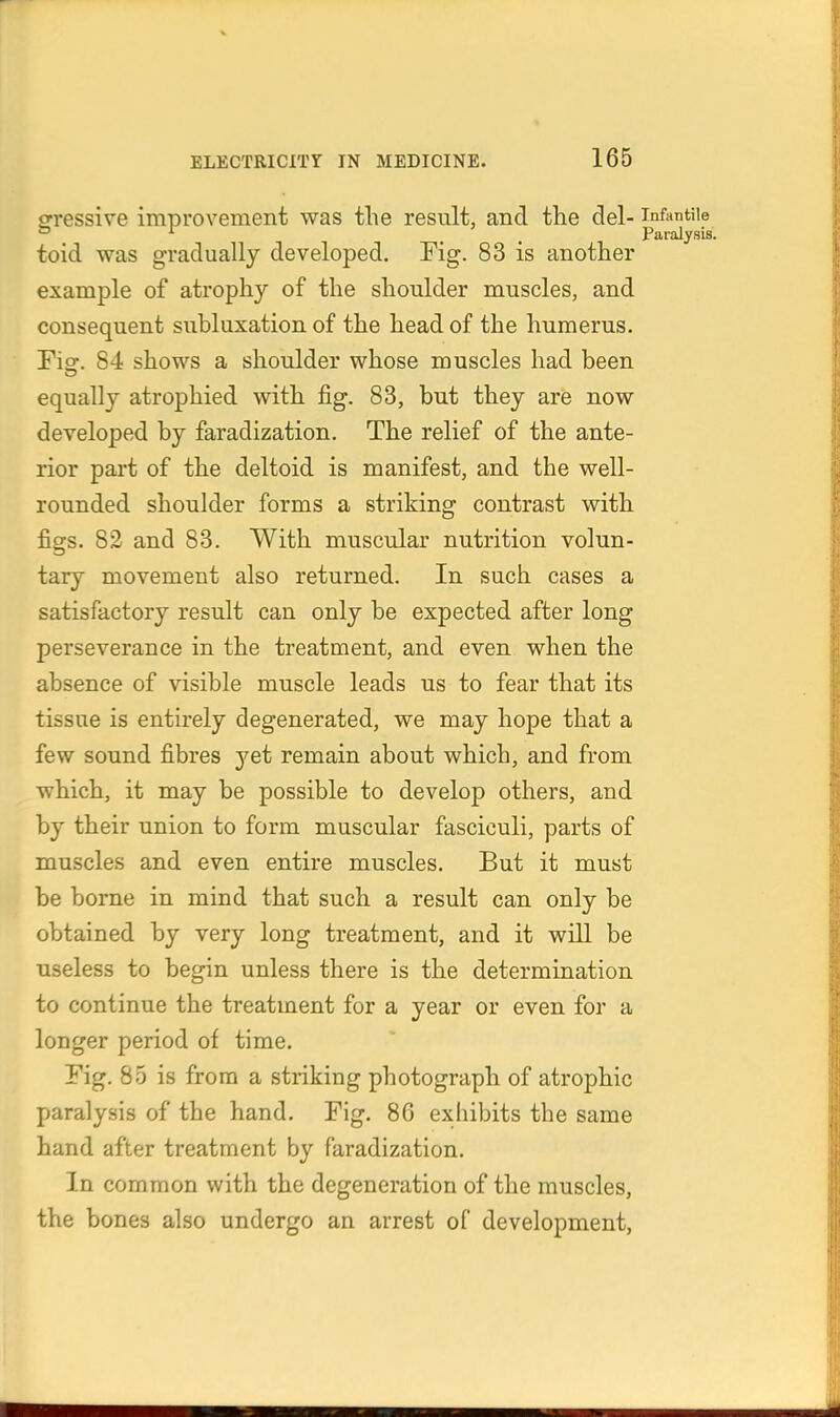 ffressive improvement was the result, and the del- infantile or ^ ^ Paralysis. toid was gradually developed. Fig. 83 is another example of atrophy of the shoulder muscles, and consequent subluxation of the head of the humerus. Fisr. 84 shows a shoulder whose muscles had been equally atrophied with fig. 83, but they are now developed by faradization. The relief of the ante- rior part of the deltoid is manifest, and the well- rounded shoulder forms a striking contrast with figs. 82 and 83. With muscular nutrition volun- tary movement also returned. In such cases a satisfactory result can only be expected after long perseverance in the treatment, and even when the absence of visible muscle leads us to fear that its tissue is entirely degenerated, we may hope that a few sound fibres yet remain about which, and from which, it may be possible to develop others, and by their union to form muscular fasciculi, parts of muscles and even entire muscles. But it must be borne in mind that such a result can only be obtained by very long treatment, and it will be useless to begin unless there is the determination to continue the treatment for a year or even for a longer period of time. Fig. 85 is from a striking photograph of atrophic paralysis of the hand. Fig. 86 exhibits the same hand after treatment by faradization. In common with the degeneration of the muscles, the bones also undergo an arrest of development,