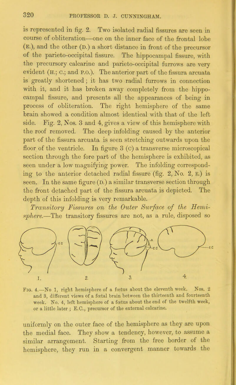 is represented in fig. 2. Two isolated radial fissures are seen in course of obliteration—one on the inner face of the frontal lobe (e.), and the other (d.) a short distance in front of the precursor of the parieto-occipital fissure. The hippocampal fissure, with the precursory calcarine and parieto-occipital furrows are very evident (h.; c; and P.O.). The anterior part of the fissura arcuata is greatly shortened ; it has two radial furrows in connection with it, and it has broken away completely from the hippo- campal fissure, and presents all the appearances of being in process of obliteration. The right hemisphere of the same brain showed a condition almost identical with that of the left side. Fig. 2, Nos. 3 and 4, gives a view of this hemisphere with the roof removed. The deep infolding caused by the anterior part of the fissura arcuata is seen stretching outwards upon the floor of the ventricle. In figure 3 (c) a transverse microscopical section through the fore part of the hemisphere is exhibited, as seen under a low magnifying power. The infolding correspond- ing to the anterior detached radial fissure (fig. 2, No. 2, e.) is seen. In the same figure (d.) a similar transverse section through the front detached part of the fissura arcuata is depicted. The depth of this infolding is very remarkable. Transitory Fissures on the Outer Surface of the Hevii- sphere.—The transitory fissures are not, as a rule, disposed so .1. 2. a 4 Fig. 4.—No 1, right hemisphere of a foetus about the eleventh week. Nos. 2 and 3, different views of a fcetal brain between the thirteenth and fourteenth week. No. 4, left hemisphere of a foetus about the end of the twelfth week, or a little later ; E.C., precursor of the external calcarine. uniformly on the outer face of the hemisphere as they are upon the medial face. They show a tendency, however, to assume a similar arrangement. Starting from the free border of the hemisphere, they run in a convergent manner towards the