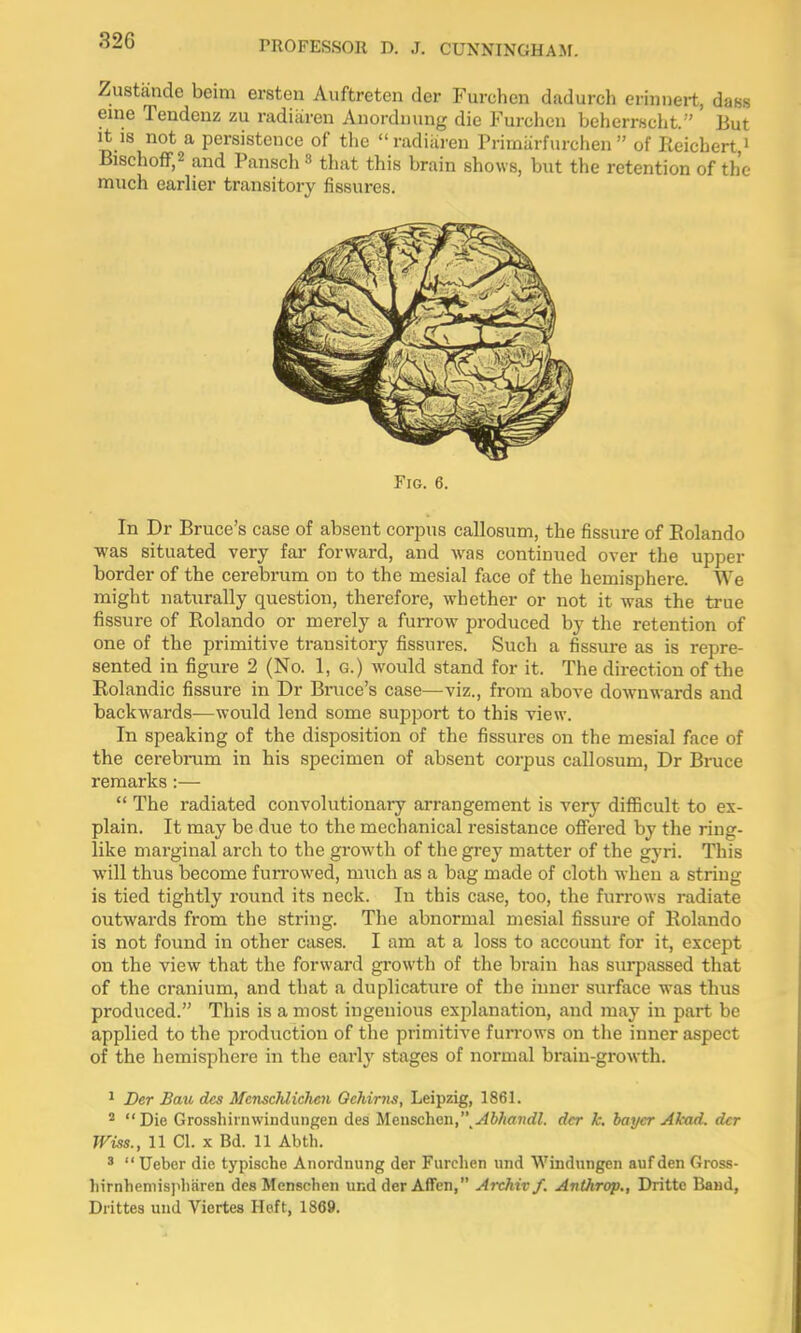 Zustande beim ersten Auftreten der Furchen dadurch eriiinert, dass eiiie Tendenz zu radiiiren Anorduung die Furcheii beherrscht. ' But It IS not a persistence of the radiiiren Primiirfurchen of Reichert ' Bischoff,2 and Pansch 3 that this brain shows, but the retention of the much earlier transitory fissures. Fig. 6. In Dr Bruce's case of absent corpus callosum, the fissure of Rolando was situated very far forward, and was continued over the upper border of the cerebrum on to the mesial face of the hemisphere. We might naturally question, therefore, whether or not it was the true fissure of Rolando or merely a fun-ow produced by the retention of one of the primitive transitory fissures. Such a fissure as is repre- sented in figure 2 (No. 1, G.) would stand for it. The direction of the Rolandic fissure in Dr Bruce's case—viz., from above downwards and backwards—would lend some support to this view. In speaking of the disposition of the fissures on the mesial face of the cerebrum in his specimen of absent corpus callosum, Dr Bruce remarks:—  The radiated convolutionary arrangement is very difficult to ex- plain. It may be due to the mechanical resistance oflPered by the ring- like marginal arch to the growth of the grey matter of the gyri. This will thus become furrowed, miich as a bag made of cloth when a string is tied tightly round its neck. In this case, too, the furrows radiate outwards from the string. The abnormal mesial fissure of Rolando is not found in other cases. I am at a loss to account for it, except on the view that the forward growth of the brain has surpassed that of the cranium, and that a duplicature of the inner surface was thus produced. This is a most ingenious exjjlanation, and may in part be applied to the production of the primitive fun-ows on the inner aspect of the hemisphere in the early stages of normal brain-growth. ^ Der Bau dcs McnscJdiclien Ochirns, Leipzig, 1861. ^ Die Grosshiinwindungen des 'iJl(i\\sc\\(ii\,'\Abhandl. der k. haycr Akad. der Wiss., 11 CI. X Bd. 11 Abth. ^  Ueber die typische Anordnung der Furchen und Windungen aiif den Gross- liirnhemispbaren des Menschen und derAffen, Archivf. Anthrop., Drittc Baud, Drittea und Viertes Heft, 1869.