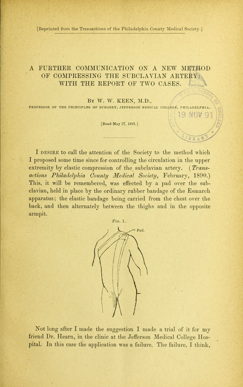 [Reprinted from the Transactions of the Philadelphia County Medical Society.] A FURTHER COMMUNICATION ON A NEW METHOD OF COMPRESSING THE SUBCLAVIAN ARTERY: ., WITH THE REPORT OF TWO CASES. ' ^ By W. W. keen, M.D., PROFESSOR OF THE PRINCIPLES OF SURGERY, JEFFERSON MEDICAJ, COLLEGE, PHILADELPHIA. [Kead May 27, 1891.] I DESIRE to call the attention of the Society to the method which I proposed some time since for controlling the circulation in the upper extremity by elastic compression of the subclavian artery. [Trans- actions PMladelfliia County Medical Society, February, 1890.) This, it will be remembered, was effected by a pad over the sub- clavian, held in place by the ordinary rubber bandage of the Esmarch apparatus; the elastic bandage being carried from the chest over the back, and then alternately between the thighs and in the opposite armpit. Fig. 1. Not long after I made the suggestion I made a trial of it for my friend Dr. Hearn, in the clinic at the Jefferson Medical College Hos-