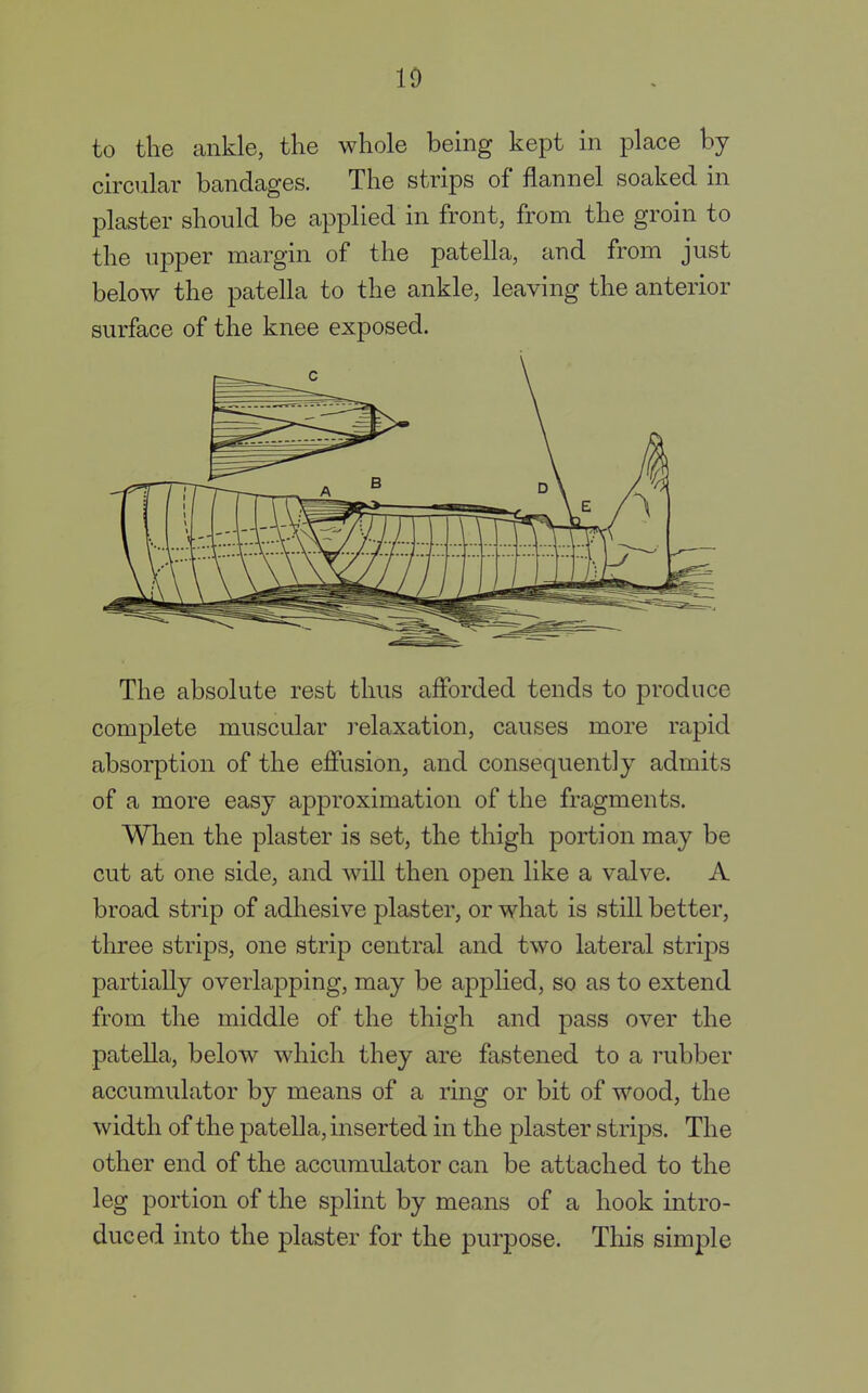 to the ankle, the whole being kept in place by circular bandages. The strips of flannel soaked in plaster should be applied in front, from the groin to the upper margin of the patella, and from just below the patella to the ankle, leaving the anterior surface of the knee exposed. The absolute rest thus afforded tends to produce complete muscular relaxation, causes more rapid absorption of the effusion, and consequently admits of a more easy approximation of the fragments. When the plaster is set, the thigh portion may be cut at one side, and will then open like a valve. A broad strip of adhesive plaster, or what is still better, three strips, one strip central and two lateral strips partially overlapping, may be applied, so as to extend from the middle of the thigh and pass over the patella, below which they are fastened to a rubber accumulator by means of a ring or bit of wood, the width of the patella, inserted in the plaster strips. The other end of the accumulator can be attached to the leg portion of the splint by means of a hook intro- duced into the plaster for the purpose. This simple