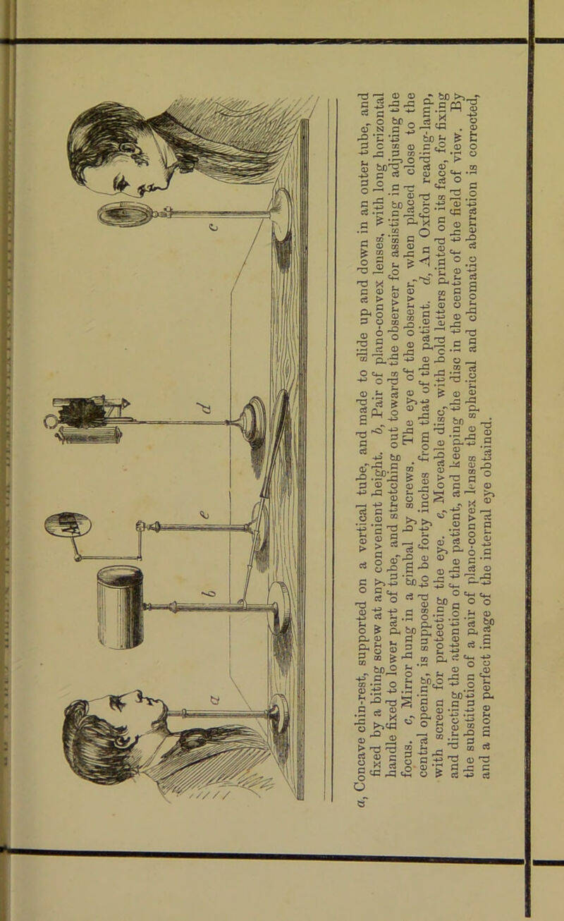 **■111 • I - hm it 111 Vif J .. . . P a „ o 0 N ■3'5 — <D 0) 2 -a .a £ so >>„ .HW ; bo £ ^ c 2 a) c c2 JP p M ^ • 0) P O O —« a I P co ^ b/D^ rr; c3 o> m c c3 ° <v o ^ ^ ^ ce o P r-r? «4H . C 0 ^ CC S .2 C . p £ -§,2 'p x P 0 cS > P O 03 2 c2 ^ s» Is ’-5 ^ ^ 5 o 2 -.2 _ O ° j= _g O! m a r-J +3 -O Qi tfl <D r, m TO w Cj ^ ^ a °.S & ._ .o . S t ‘•'8 G' l S . £ _ £ S-g5 2 0 CO rtS -*? 133 o _g -o .£ ,2 -a o rO t- c3 p 3 M o O c*_ 03 < -M o ^ 0 .5- e§ 'g C8 ^ SPh.S c .« t3 % O _ rd . 03 c- r, -P^.h w o >) 0 c3 a) 5 .2 bn S ® 2 »> .+3 O , ’0*30 g ^ § . ° N - -g tc e£ -g 0 ,-rrp a _• « a 0 K/5 0 Pi. 0 ■ p0O0Soca; «u n t_ —H M r—< 73 -g is ”.g „-*r g .11 “ >>>,« § > .'So 02?_ ,O0c30 ► t >>^6 03 «-2.S'° ©-22 k>45 bo s =*-■ a o c3 *£ . ci +3 +3 *+- e3 np . O C4_ g>H ° ■5 o ?h s & ft bo g; § c d- P V, « -  3<S ® 3 g “ 6^ - “2 g ■+3 P _ t, gV3 ° c3 -3 -u 0 J o P U. -*3 p. cf <=+-. o cD2 -*■ 2 ■- ho  g 2 T3 ^ 3 a a s ^0 ^ M. c3 fc- -Q > ^ ^ 2-2^2^ “ Sss§o^2®2 gtC^Jc® 0 ^ - 2 — p ee c3 more perfect image of the internal eye obtained.