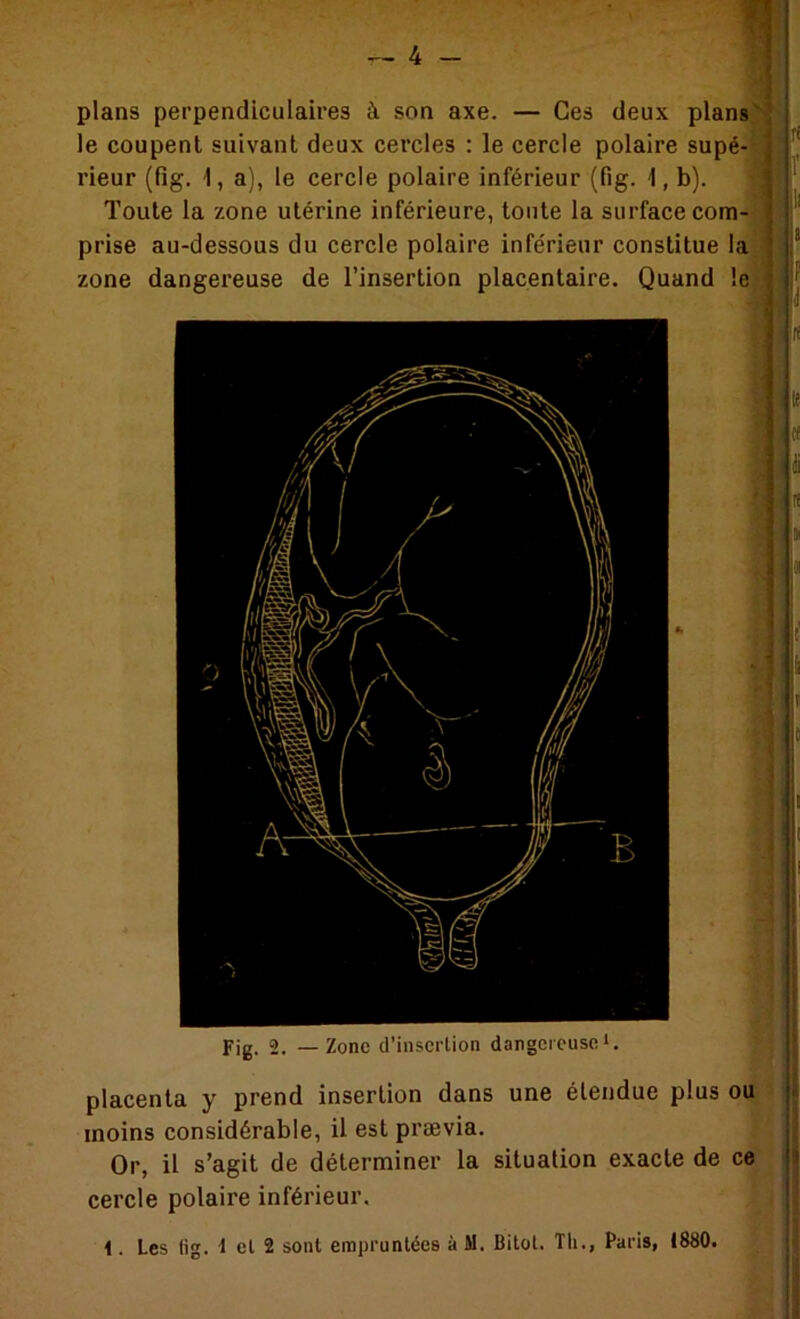 4 - .JL S plans perpendiculaires à son axe. — Ges deux plans]^ le coupent suivant deux cercles : le cercle polaire supé-- rieur (fig. 1, a), le cercle polaire inférieur (fig. \, b). Toute la zone utérine inférieure, tonte la surface com- prise au-dessous du cercle polaire inférieur constitue la zone dangereuse de l’insertion placentaire. Quand le . ri , I» ■ I i! Fig. 2. — Zone d’insertion dangereuse*. placenta y prend insertion dans une étendue plus ou,.: moins considérable, il est prævia. Or, il s’agit de déterminer la situation exacte de ce cercle polaire inférieur. j