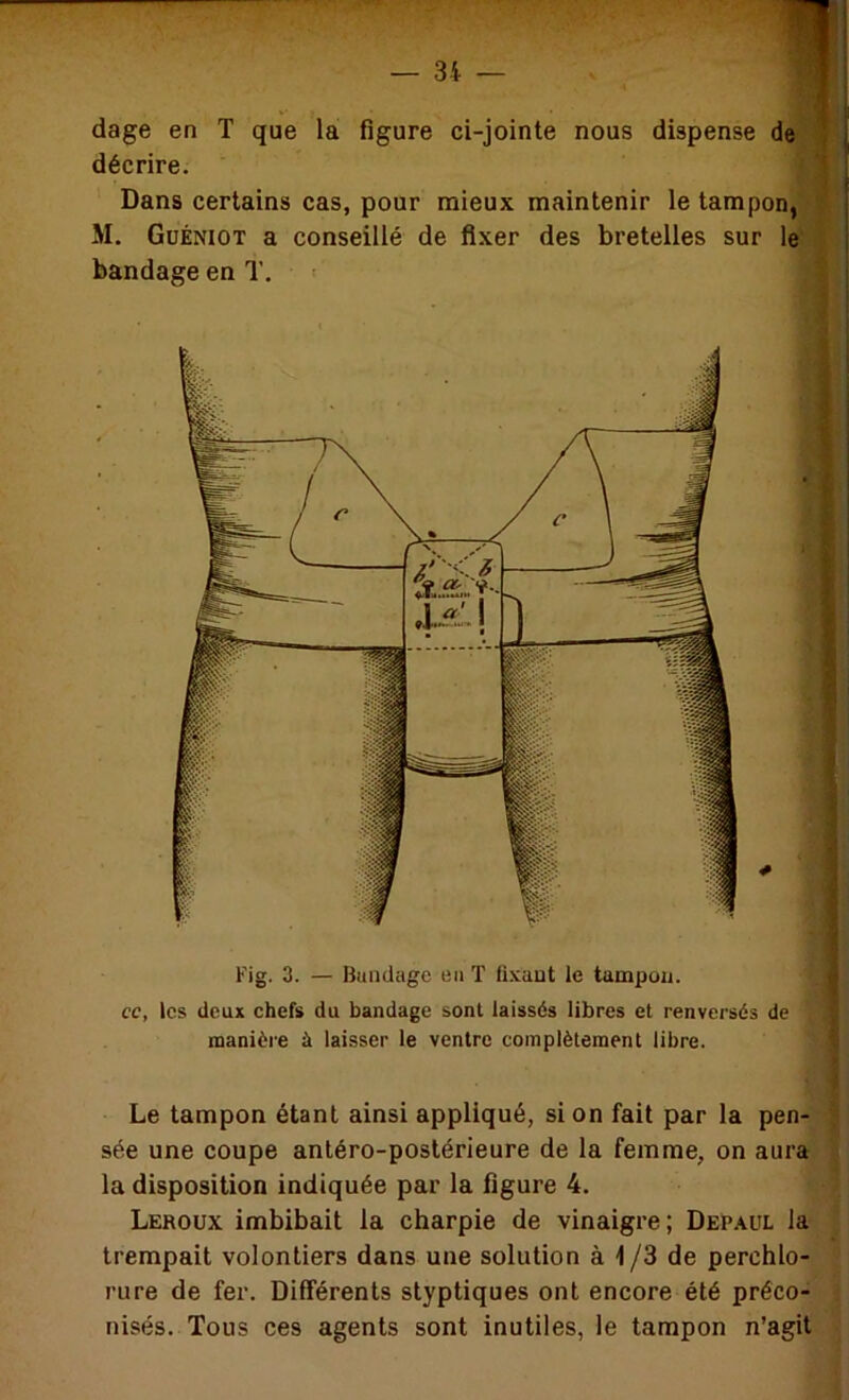 dage en T que la figure ci-jointe nous dispense de décrire. Dans certains cas, pour naieux maintenir le tampon, M. Güéniot a conseillé de fixer des bretelles sur le bandage en T, ■ Le tampon étant ainsi appliqué, si on fait par la pen- sée une coupe antéro-postérieure de la femme, on aura la disposition indiquée par la figure 4. Leroux imbibait la charpie de vinaigre; Depaul la trempait volontiers dans une solution à i/3 de perchlo- rure de fer. Différents styptiques ont encore été préco- nisés. Tous ces agents sont inutiles, le tampon n’agit Fig. 3. — Bandage en T fixant le tampon. cc, les deux chefs du bandage sont laissés libres et renversés de manière à laisser le ventre complètement libre.