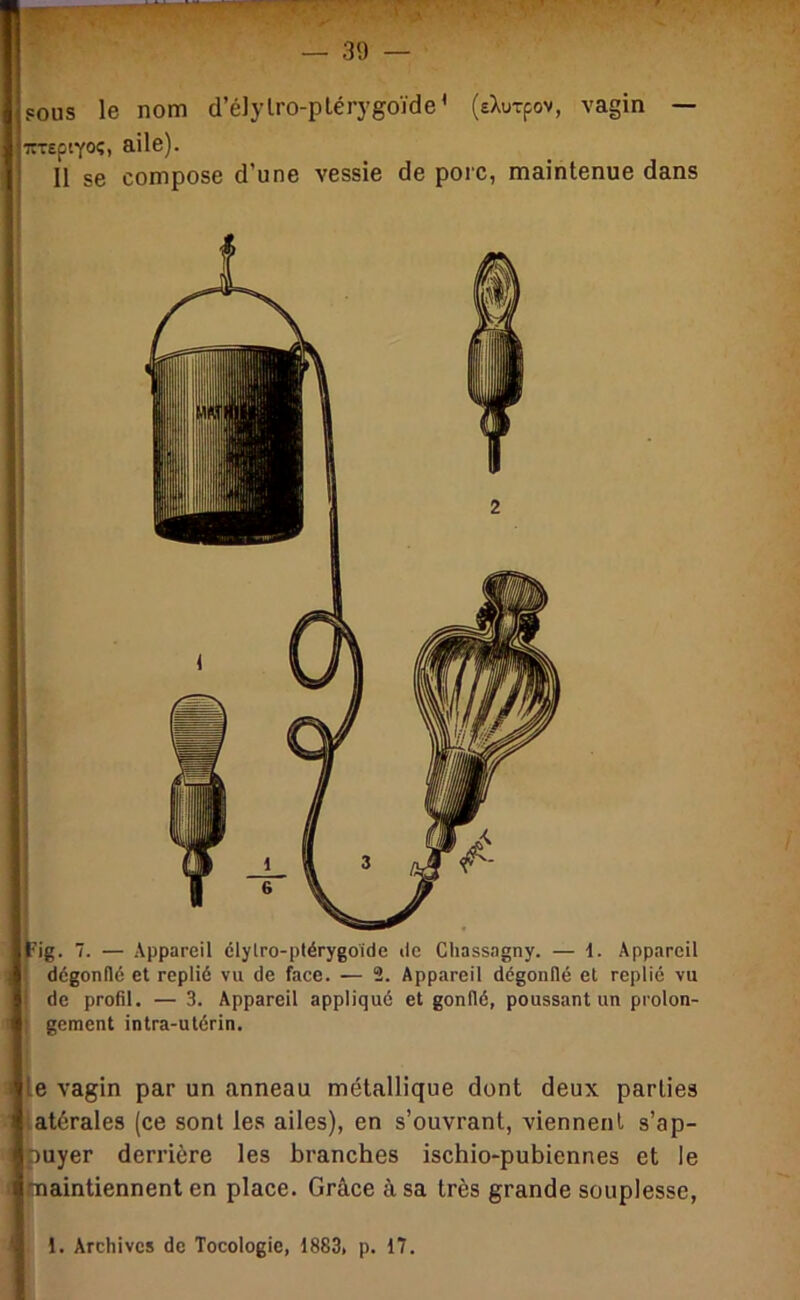 sous le nom d’élylro-plérygoïde’ (eXurpov, vagin — rTepiYOî» *^>1®)- 11 se compose d’une vessie de porc, maintenue dans t Fig. 7. — Appareil clylro-ptérygoïde «le Chassagny. — i. Appareil ! dégonflé et replié vu de face. — 2. Appareil dégonflé et replié vu I de profil. — 3. Appareil appliqué et gonflé, poussant un prolon- ; gement intra-utérin. le vagin par un anneau métallique dont deux parties iatérales (ce sont les ailes), en s’ouvrant, viennent s’ap- puyer derrière les branches ischio-pubiennes et le .maintiennent en place. Grâce à sa très grande souplesse,