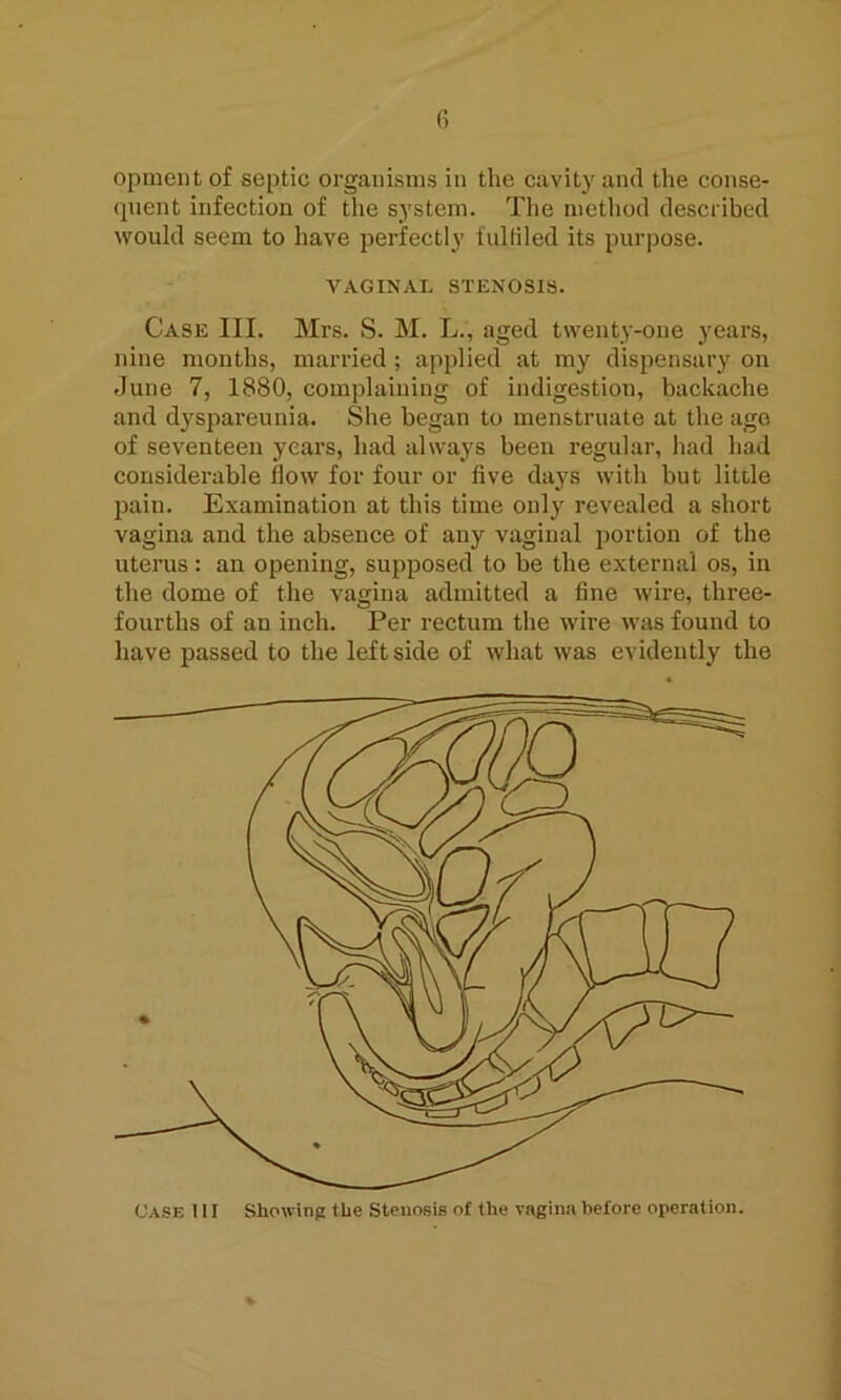 fi opmentof septic organisms in the cavity and the conse- quent infection of the system. The method described would seem to have perfectly iulliled its purpose. VAGINAL STENOSIS. Case III. Mrs. S. M. L., aged twenty-one years, nine months, married ; applied at my dispensary on June 7, 1880, complaining of indigestion, backache and dyspareunia. She began to menstruate at the age of seventeen years, had always been regular, had had considerable flow for four or five days with but little pain. Examination at this time only revealed a short vagina and the absence of any vaginal portion of the uterus: an opening, supposed to be the external os, in the dome of the vagina admitted a fine wire, three- fourths of an inch. Per rectum the wire was found to have passed to the left side of what was evidently the