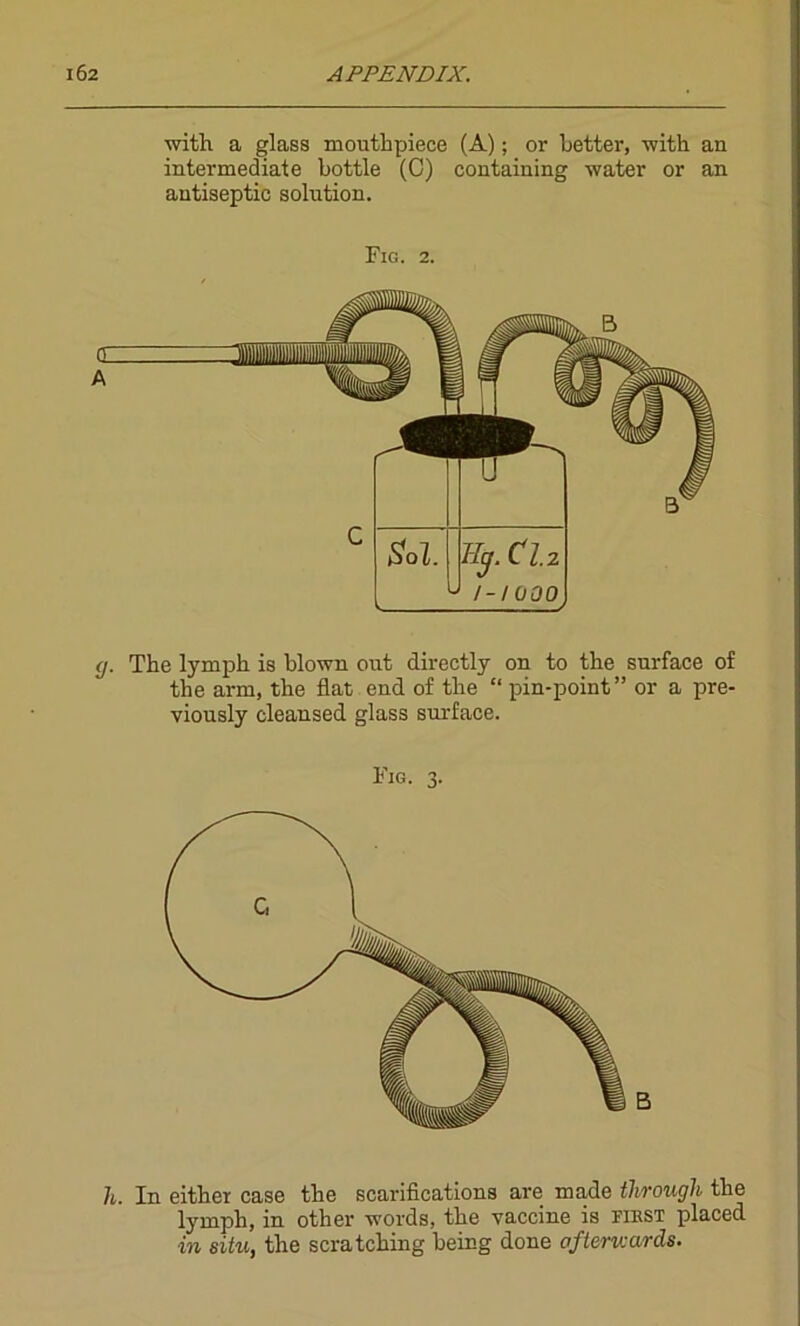 with a glass mouthpiece (A); or Letter, with an intermediate bottle (C) containing water or an antiseptic solution. Fig. 2. </. The lymph is blown out directly on to the surface of the arm, the flat end of the “ pin-point” or a pre- viously cleansed glass surface. Fig. 3. B h. In either case the scarifications are made through the lymph, in other words, the vaccine is first placed in situ, the scratching being done afterwards.