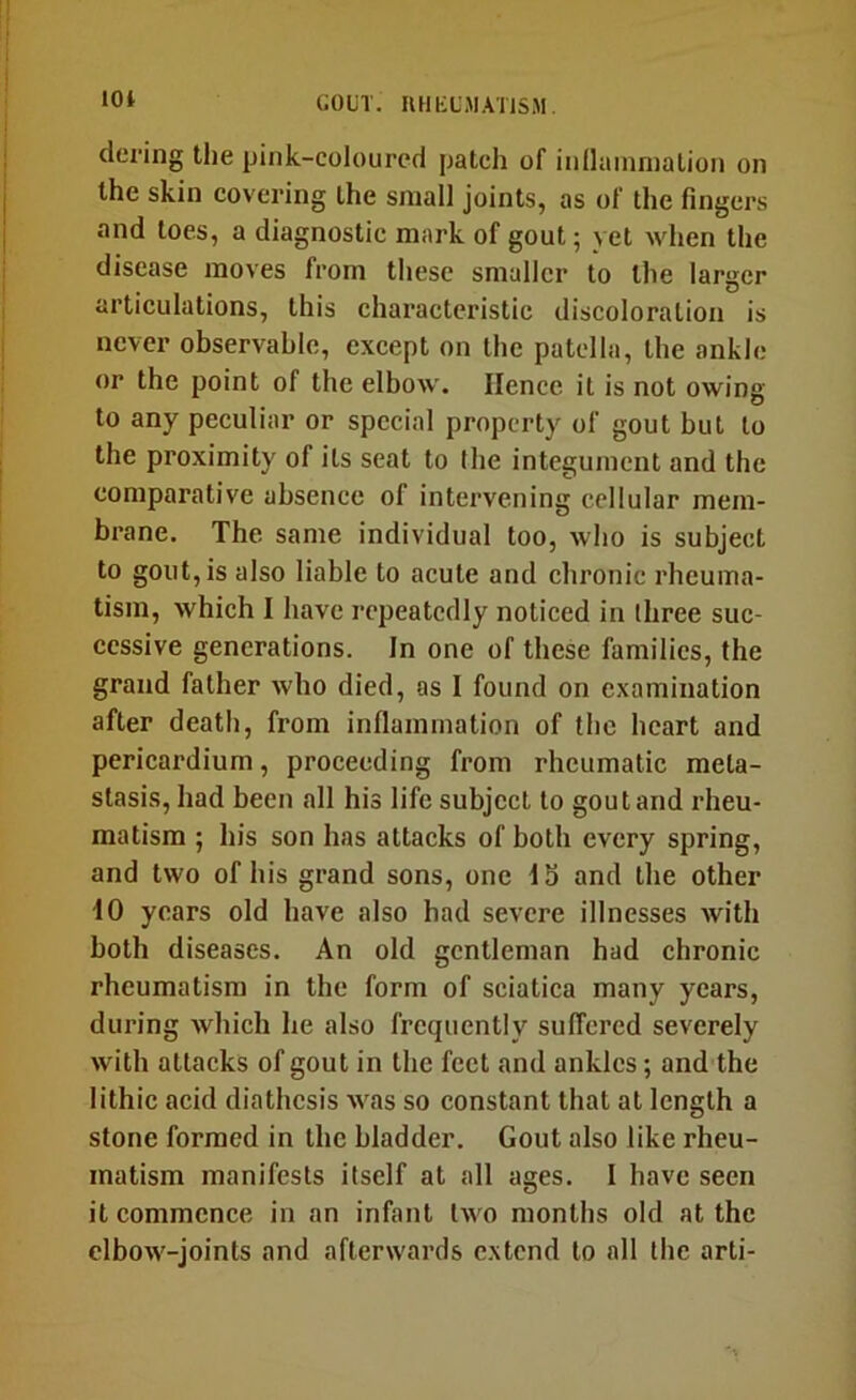 lOi dci-ing the pink-coloured patch of inllamniation on the skin covering the small joints, as of the fingers and toes, a diagnostic mark of gout; yet when the disease moves from these smaller to the larger articulations, this characteristic discoloration is never observable, except on the patella, the ankle or the point of the elbow. Hence it is not owing to any peculiar or special property of gout but to the proximity of its seat to (he integument and the comparative absence of intervening cellular mem- brane. The same individual too, who is subject to gout, is also liable to acute and chronic rheuma- tism, which I have repeatedly noticed in three suc- cessive generations. In one of these families, the grand father who died, as I found on examination after death, from inflammation of the heart and pericardium, proceeding from rheumatic meta- stasis, had been all his life subject to gout and rheu- matism ; his son has attacks of both every spring, and two of his grand sons, one 15 and the other 10 years old have also had severe illnesses with both diseases. An old gentleman had chronic rheumatism in the form of sciatica many years, during which he also frequently suffered severely with attacks of gout in the feet and ankles; and the lithic acid diathesis was so constant that at length a stone formed in the bladder. Gout also like rheu- matism manifests itself at all ages. I have seen it eommence in an infant two months old at the elbow-joints and afterwards extend to all the arti-