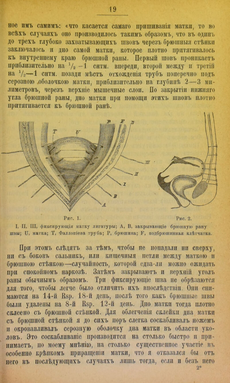 ное имъ самимъ: «что касается самаго нришиванія матки, то во всѣхъ случаяхъ оно производилось такимъ образомъ, что въ одинъ до трехъ глубоко захватывающихъ швовъ черезъ брюшныя стѣнки заключалось и дно самой матки, которое плотно притягивалось къ внутреннему краю брюшной рапы. Первый шовъ пронпкаетъ приблизительно на 1/а -1 снтм. впереди, второй между и третій на Уя—1 снтм. позади мѣстъ отхожденія трубъ поперечно иодъ серозного оболочкою матки, приблизительно на глубинѣ 2—3 ми- лпметровъ, черезъ верхніе мышечные слои. По закрытіи нижняго угла брюшной раны, дно матки ири помощи этихъ швовъ плотно притягивается къ брюшной ранѣ. Риг. 1. . Рис. 2. I, II, III, фиксирующая матку лигатуры; А, В, закрынающіе брюшпую рану швы; И, матка; Т, Фаллопіева труба; Р, брюшина; Б1, подбрюшинная клѣтчатка. При этомъ слѣдятъ за тѣмъ, чтобы не попадали ни сверху, ни съ боковъ сальникъ, или кигаечныя петли между маткою и брюшною стѣнкою—случайность, которой едва-ли можно ояшдать при спокойномъ наркозѣ. Затѣмъ закрываютъ и верхній уголъ раны обычнымъ образомъ. Три фиксирующіе шва не обрѣзаются для того, чтобы легче было отличить ихъ впослѣдствіи. Они сни- маются на 14-й йзр. 18-й день, послѣ того какъ брюшные швы были удалены на 8-й Кзр. 12-й день. Дно матки тогда плотно склеено съ брюшной стѣнкой. Для облегченія склейки дна матки съ брюшной стѣнкой я до сихъ норъ слегка соскабливалъ ножемъ и окровавливалъ серозную оболочку дна матки въ области уко- ловъ. Это соскабливаніе производится на столько быстро и при- нимает^ по моему мнѣнію, на столько существенное участіе въ особенно крѣпкомъ приращеиіи матки, что я отказался бы отъ него въ послѣдующихъ случаяхъ лишь тогда, если и безъ него 2*