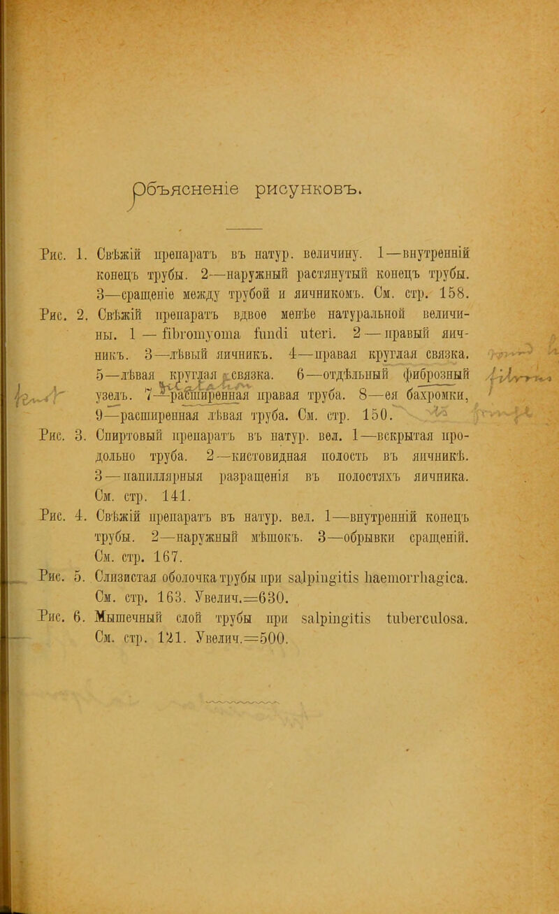 ✓ сненіе рисунковъ. Рис. 1. Свѣжій препаратъ въ натур, величину. 1—внутренній конецъ трубы. 2—наружный растянутый конецъ трубы. 3—сращеніе между трубой и яичникомъ. См. стр. 158. Рис. 2. Свѣжій препаратъ вдвое менѣе натуральной величи- ны. 1 — Шп'отуоша ішкіі піегі. 2 — правый яич- никъ. 3—лѣвый яичникъ. 4—правая круглая связка. ' 5—лѣвая ( круглая г; связка. 6—отдѣльный фиброзный узелъ. 7—расширенная правая труба. 8—ея бахромки, 9—расширенная лѣвая труба. См. стр. 150. Рис. 3. Спиртовый препаратъ въ натур, вел. 1—вскрытая про- дольно труба, 2 —кистовидная полость въ яичникѣ. 3 — папиллярныя разращенія въ полостяхъ яичника. См. стр. 141. Рис. 4. Свѣжій препаратъ въ натур, вел. 1—внутренній конецъ трубы. 2—наружный мѣшокъ. 3—обрывки сращеній. См. стр. 167. Рис. 5. Слизистая оболочка трубы при заірт&іііз 1іаетогг1іа§іса. См. стр. 163. Увелич.=630. Рис. 6. Мышечный слой трубы при 8аІріп§іІІ8 ІиЪегсиІоза. См. стр. 121. Увелич.=500.